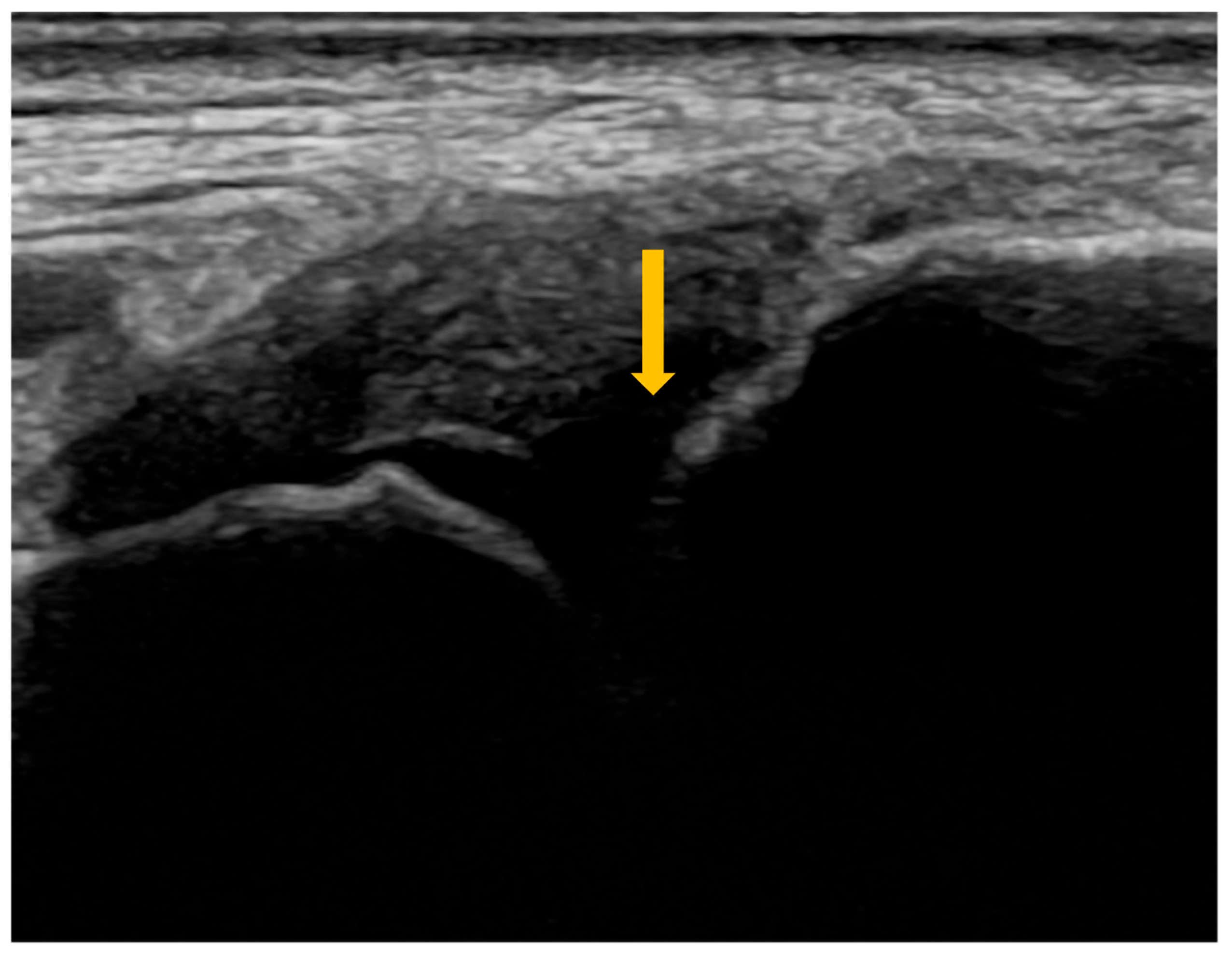 Diagnostics 16 00358 g002 Diagnostics 16 00358 g002