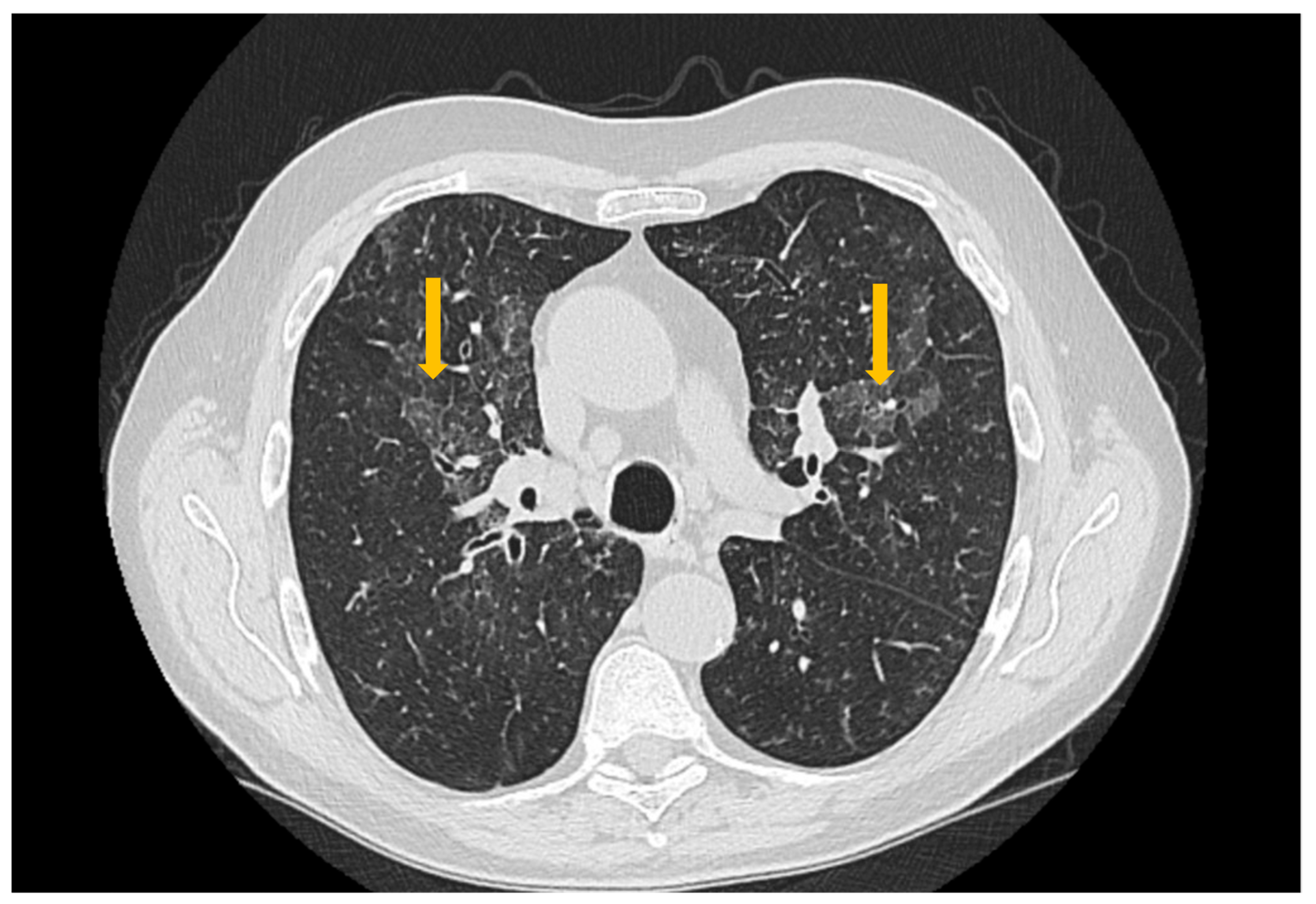 Diagnostics 16 00358 g003 Diagnostics 16 00358 g003