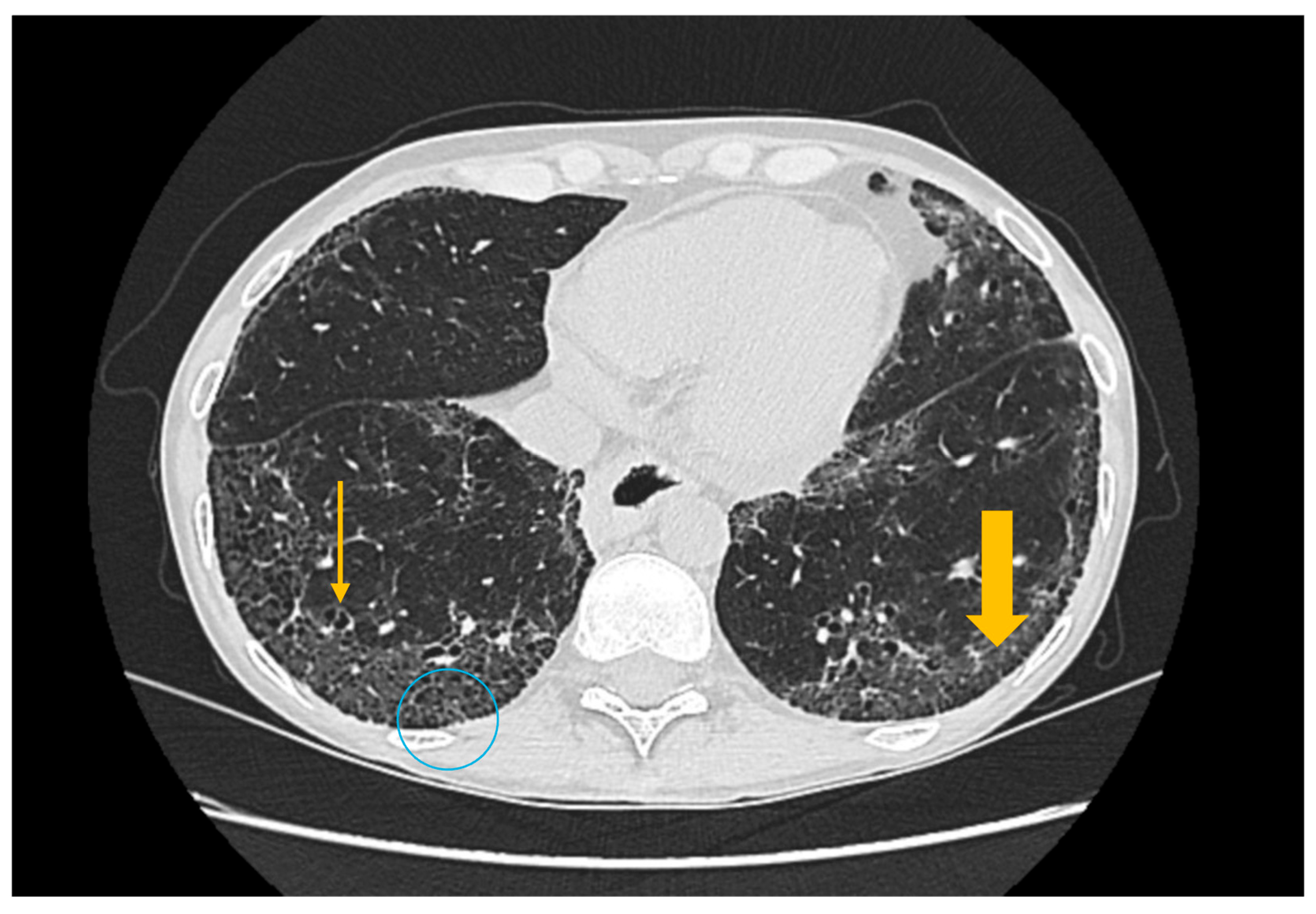 Diagnostics 16 00358 g004 Diagnostics 16 00358 g004