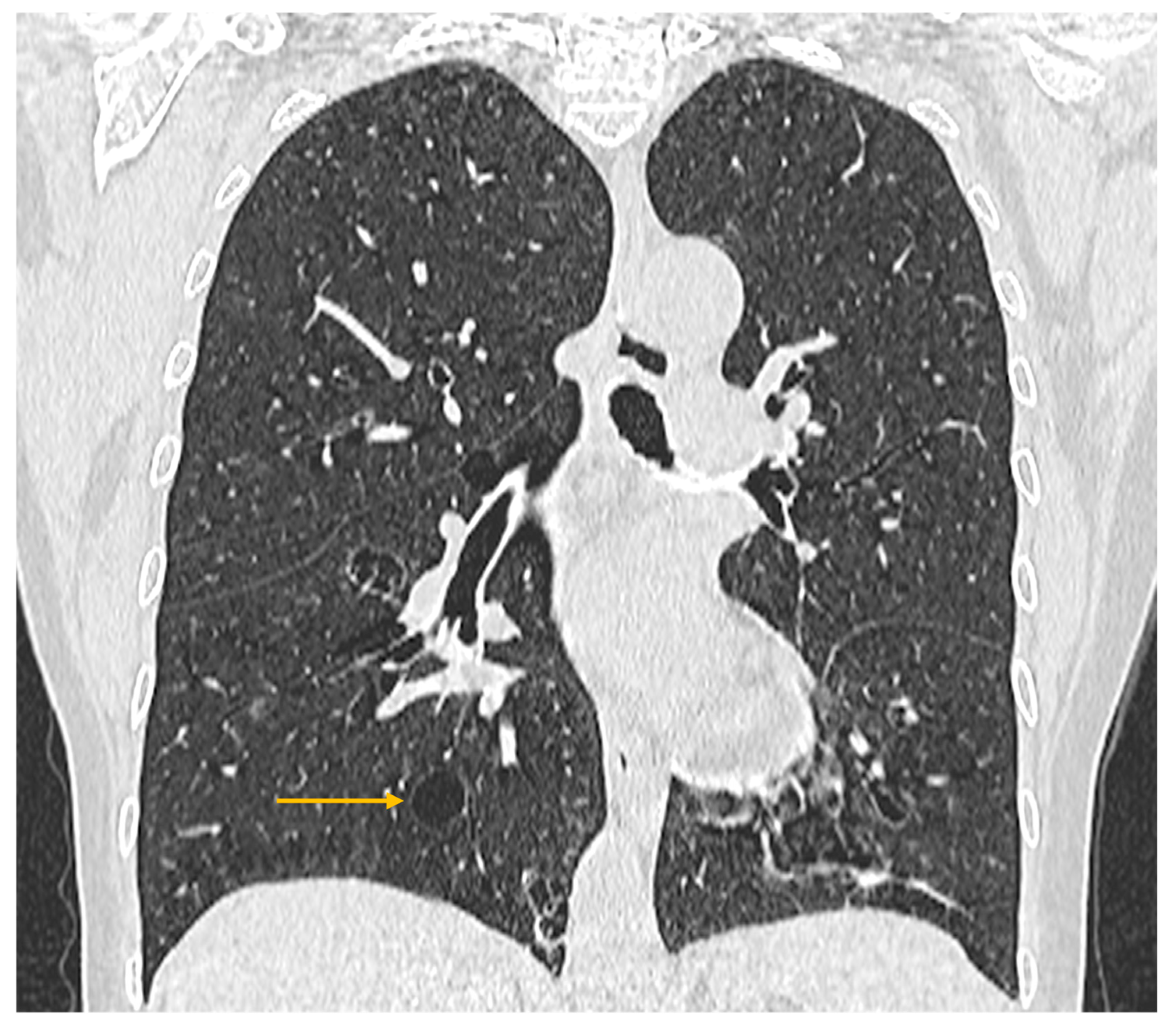 Diagnostics 16 00358 g005 Diagnostics 16 00358 g005