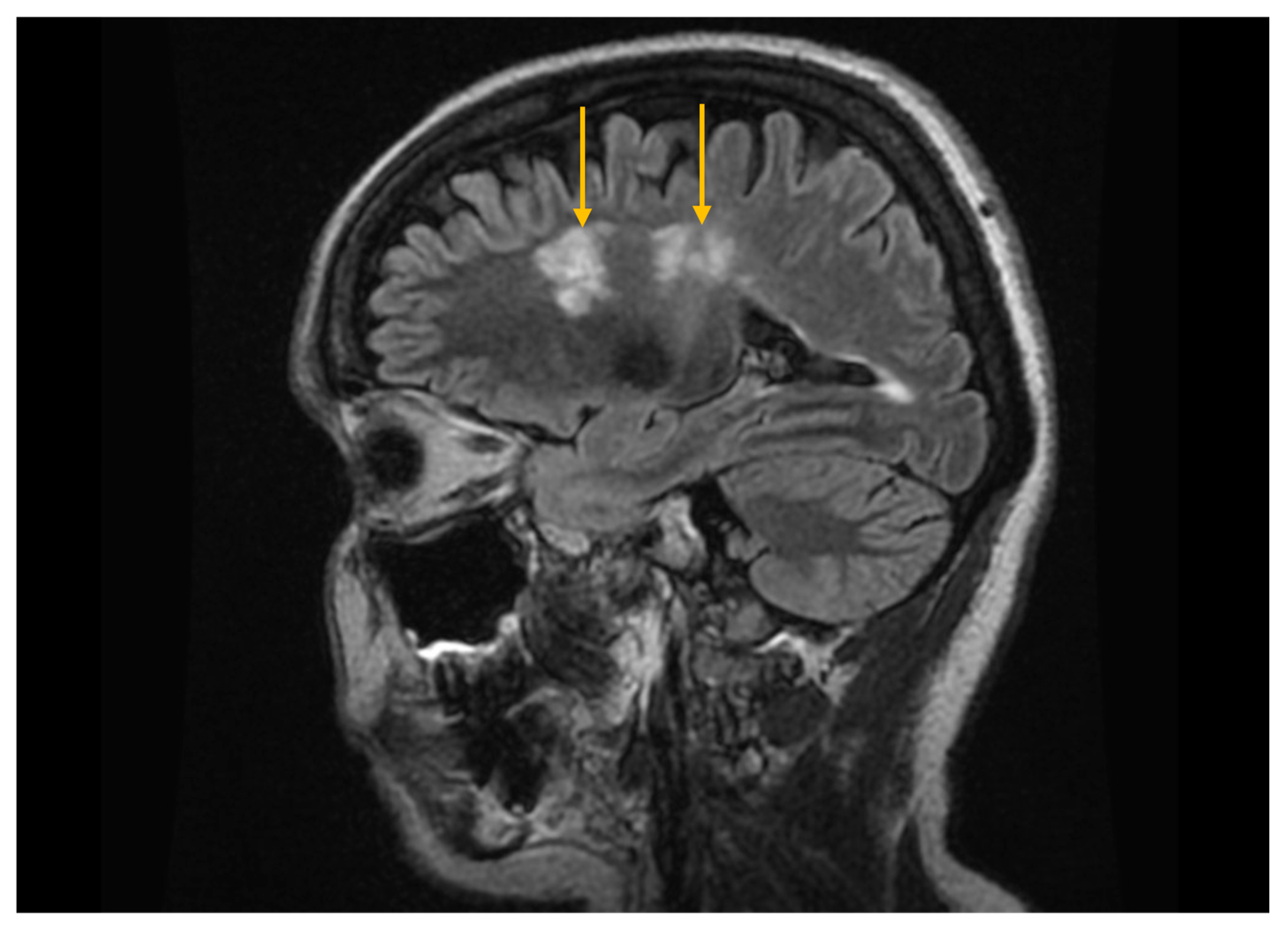 Diagnostics 16 00358 g006 Diagnostics 16 00358 g006