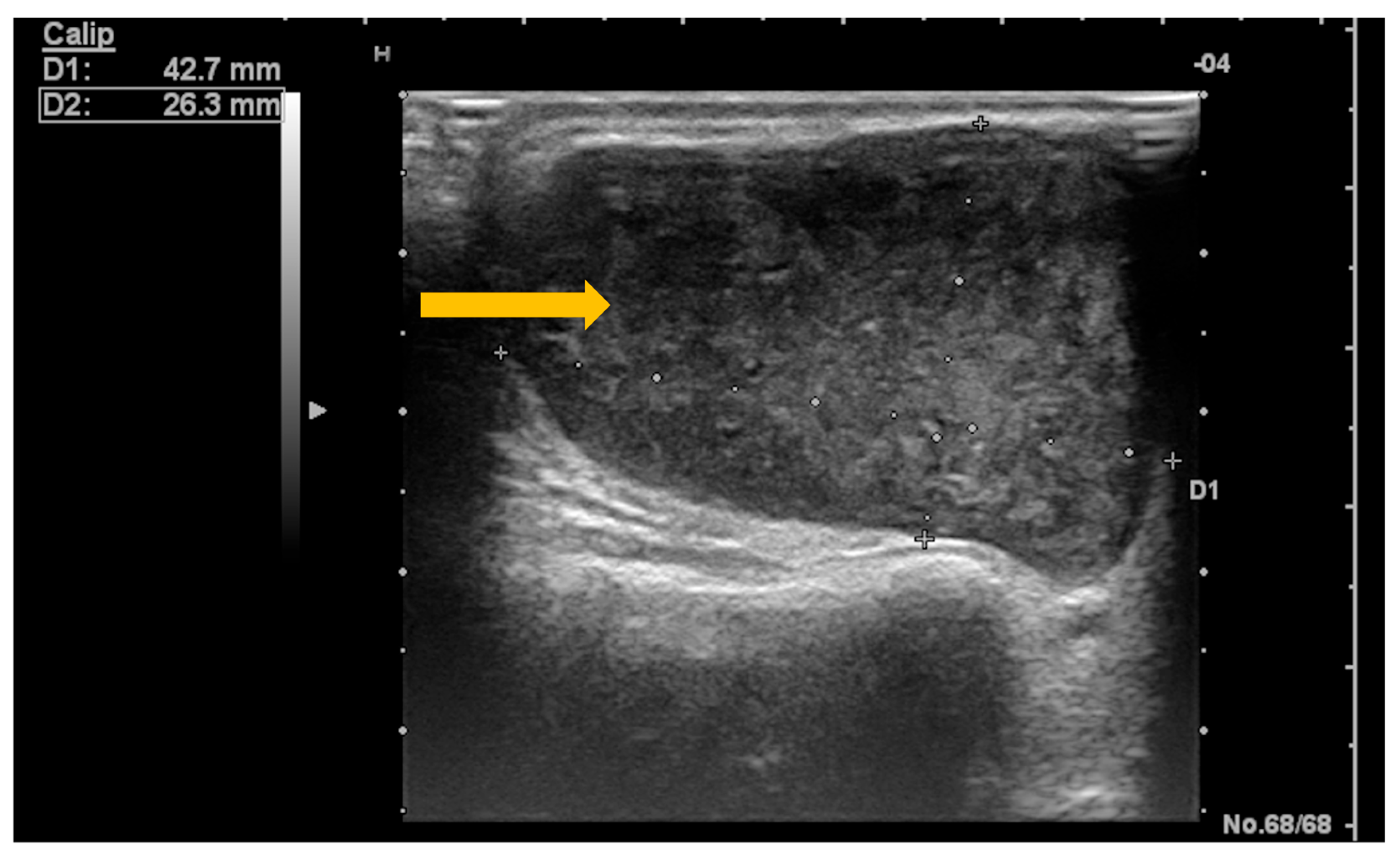 Diagnostics 16 00358 g008 Diagnostics 16 00358 g008