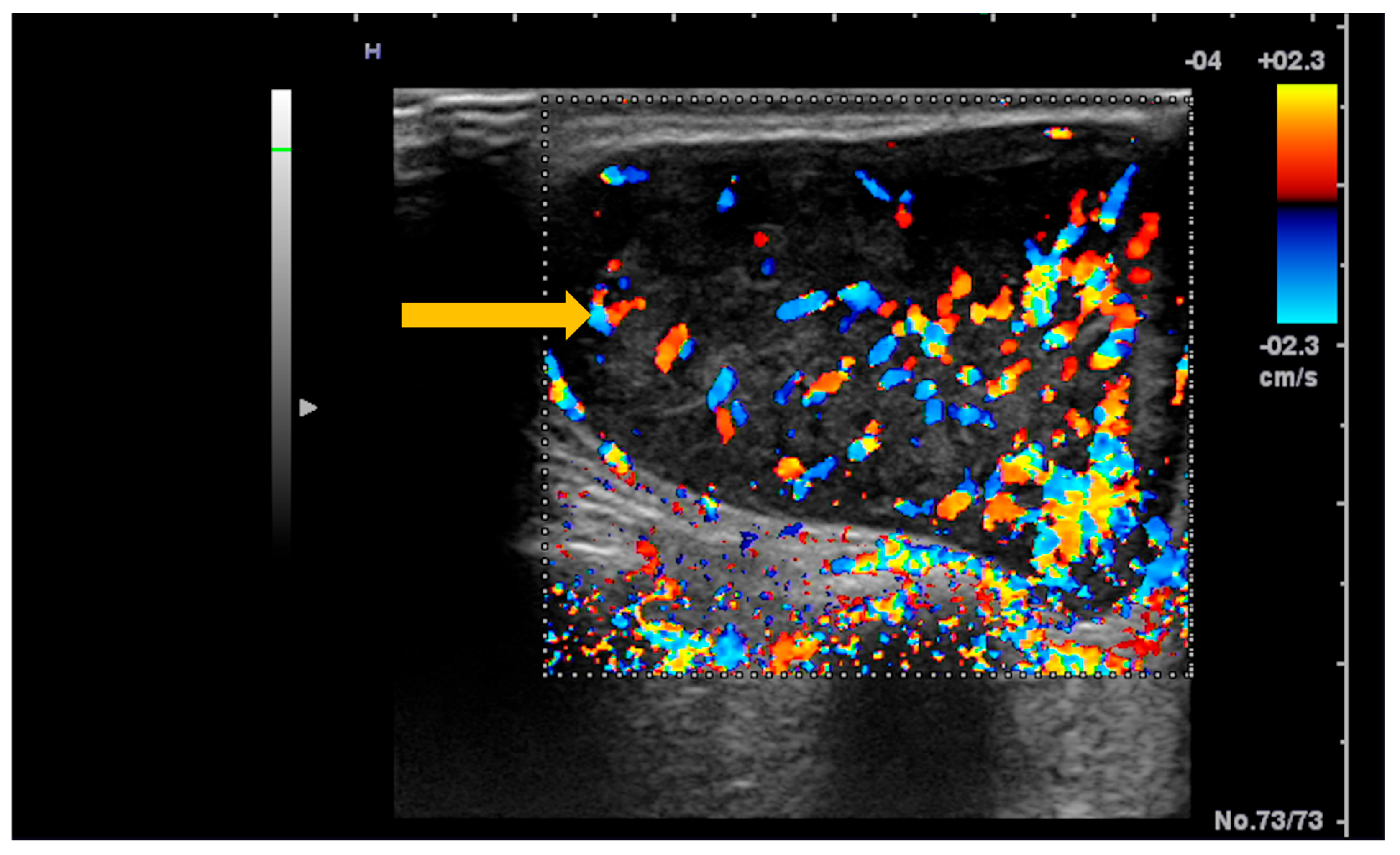 Diagnostics 16 00358 g009 Diagnostics 16 00358 g009