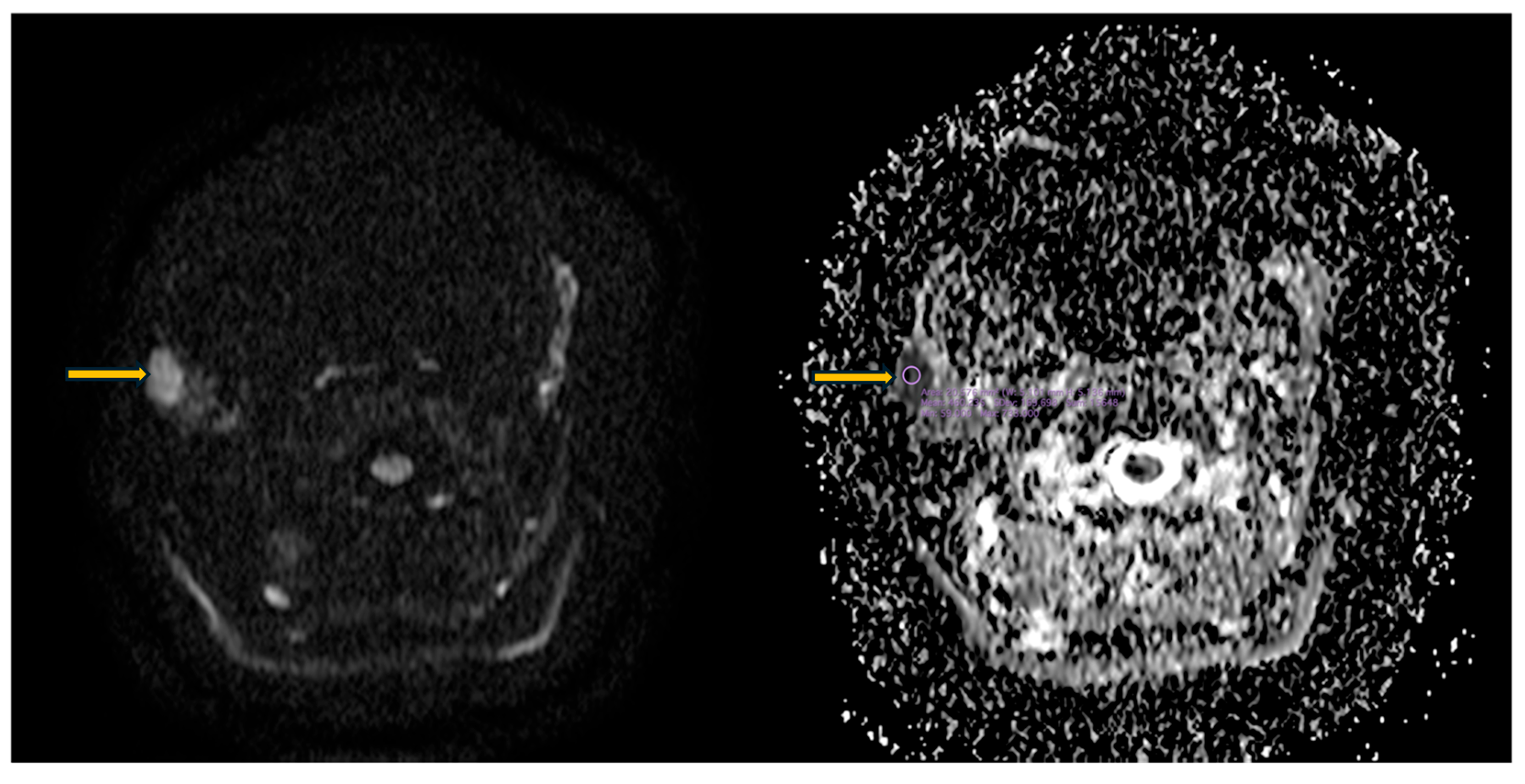 Diagnostics 16 00358 g010 Diagnostics 16 00358 g010