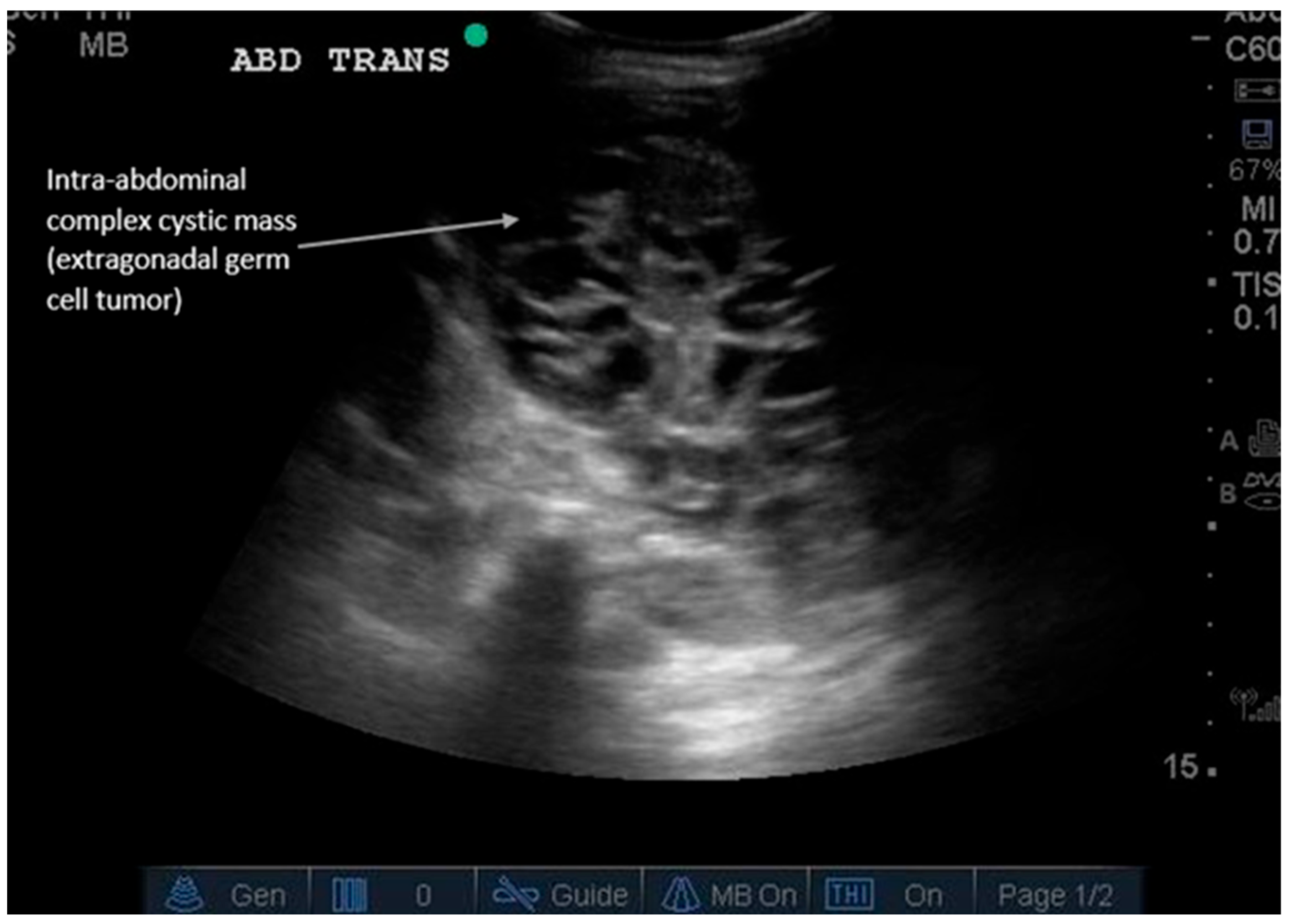 Diagnostics 16 00418 g006 Diagnostics 16 00418 g006