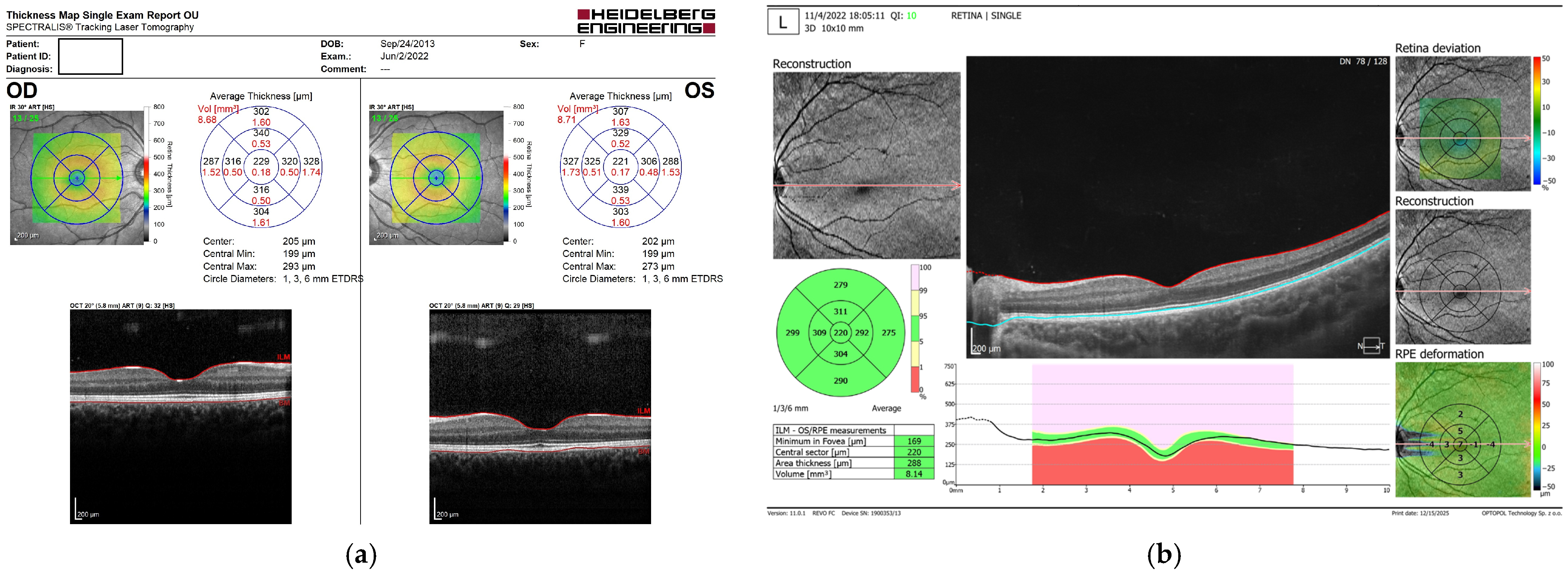 Diagnostics 16 00609 g001
