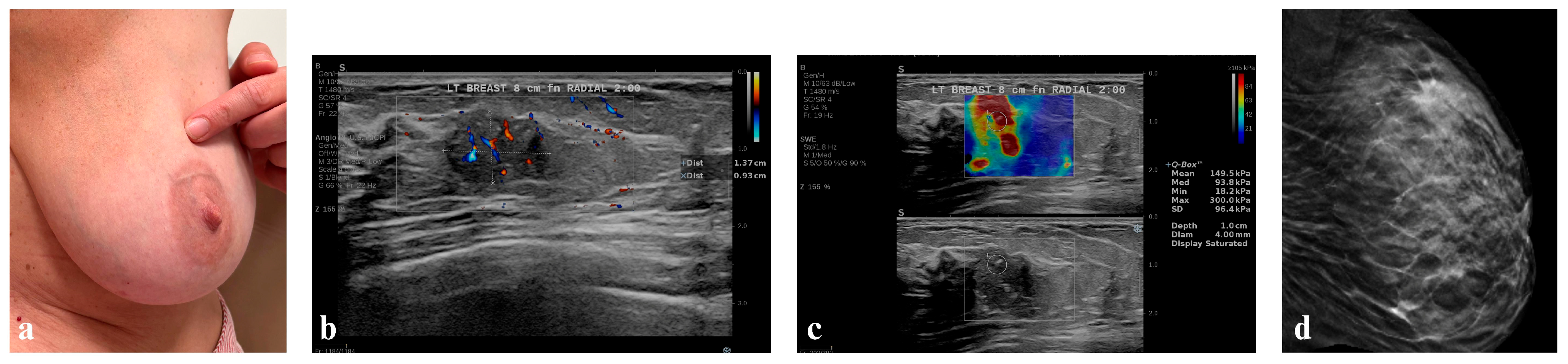 Diagnostics 16 00642 g007