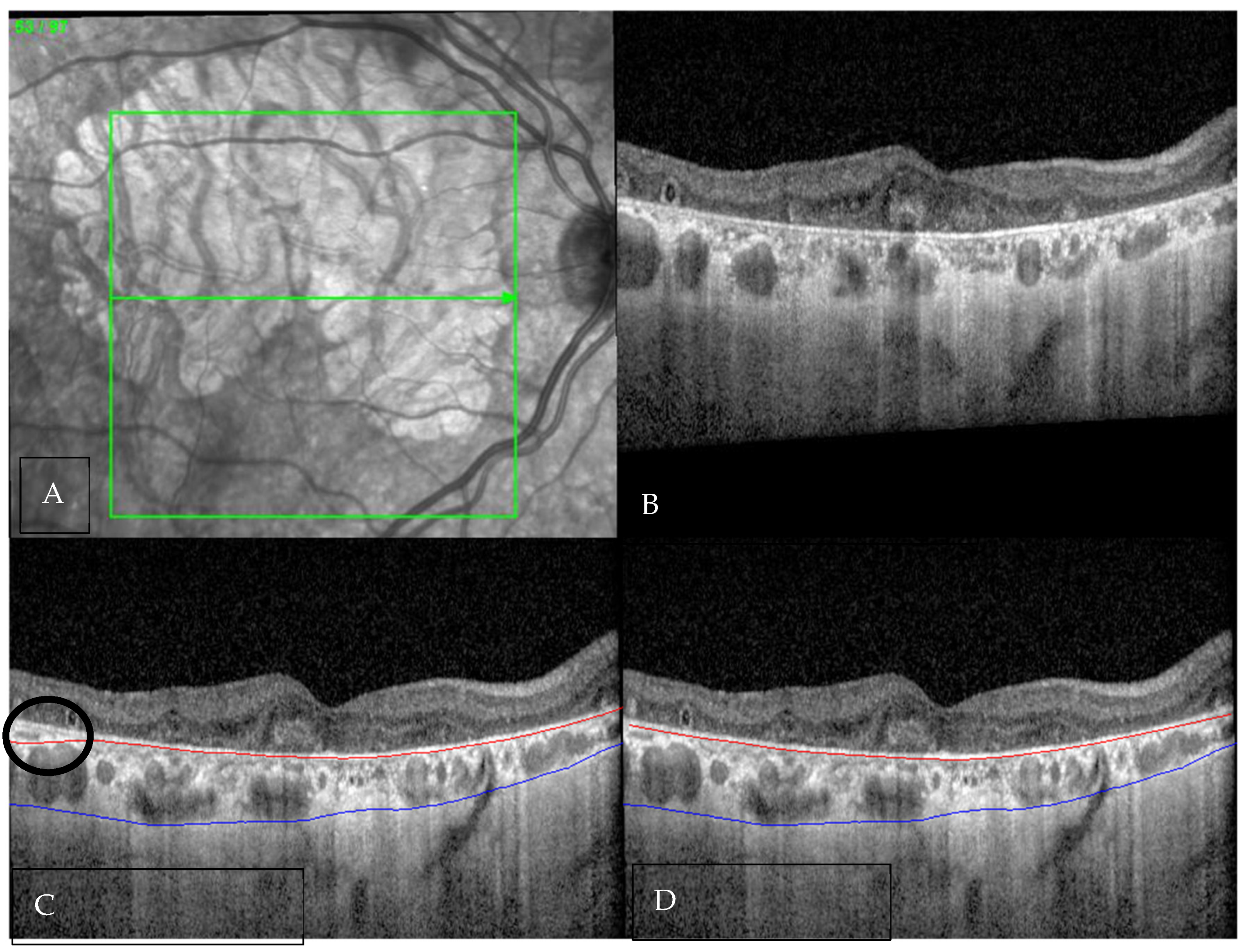 Diagnostics 16 00737 g001