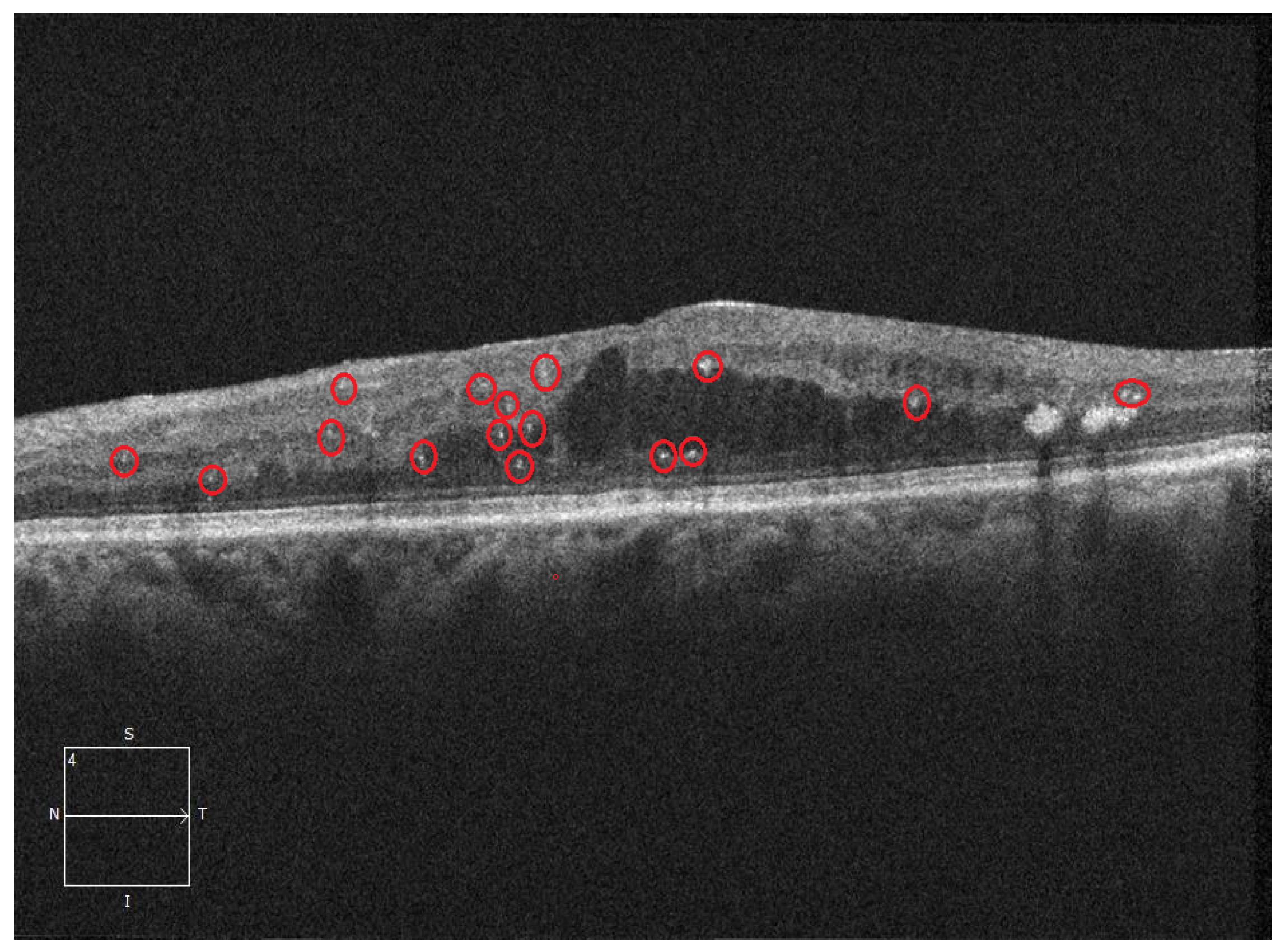 Diagnostics 16 00853 g001