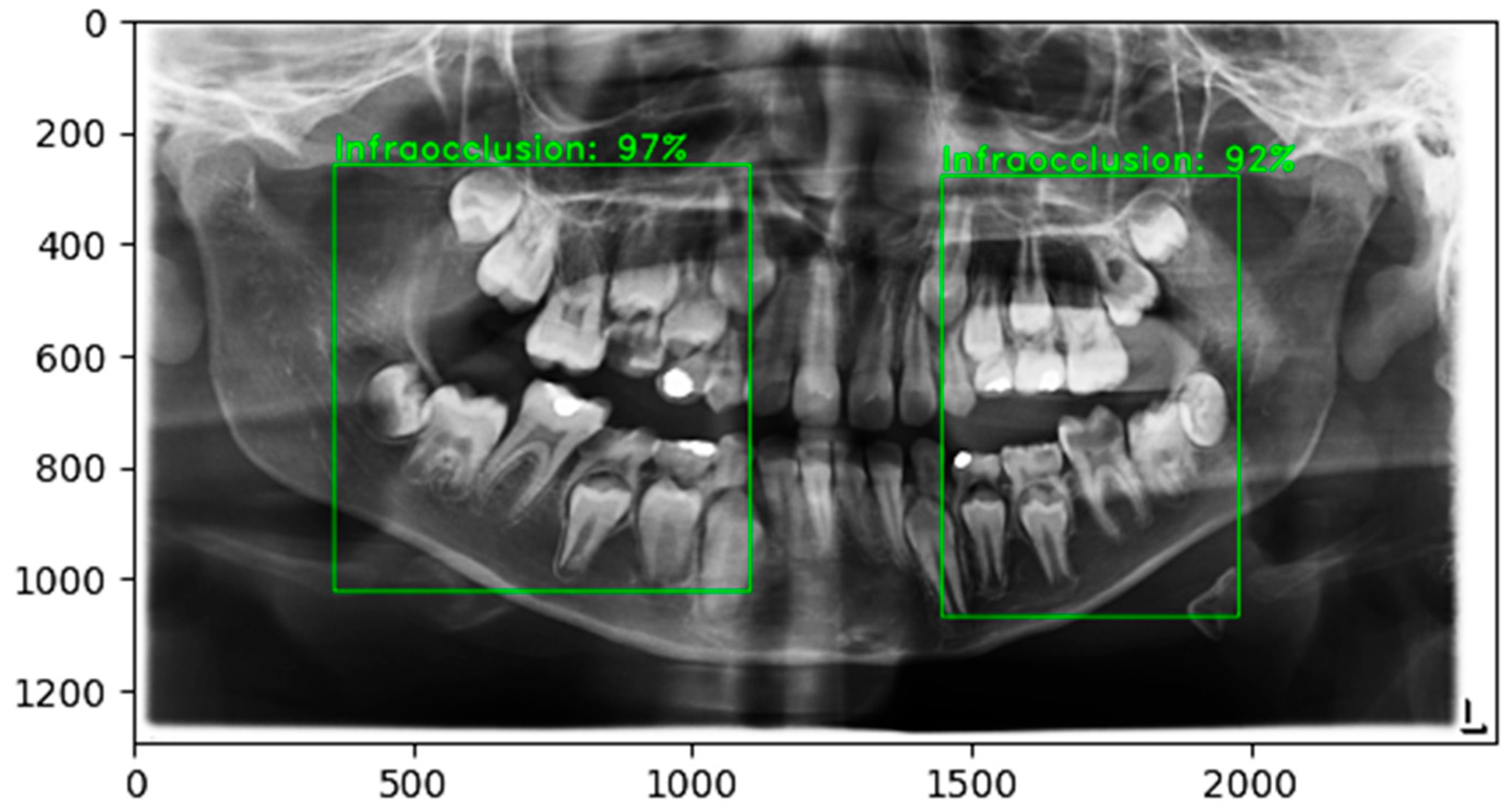 Diagnostics 16 00866 g005