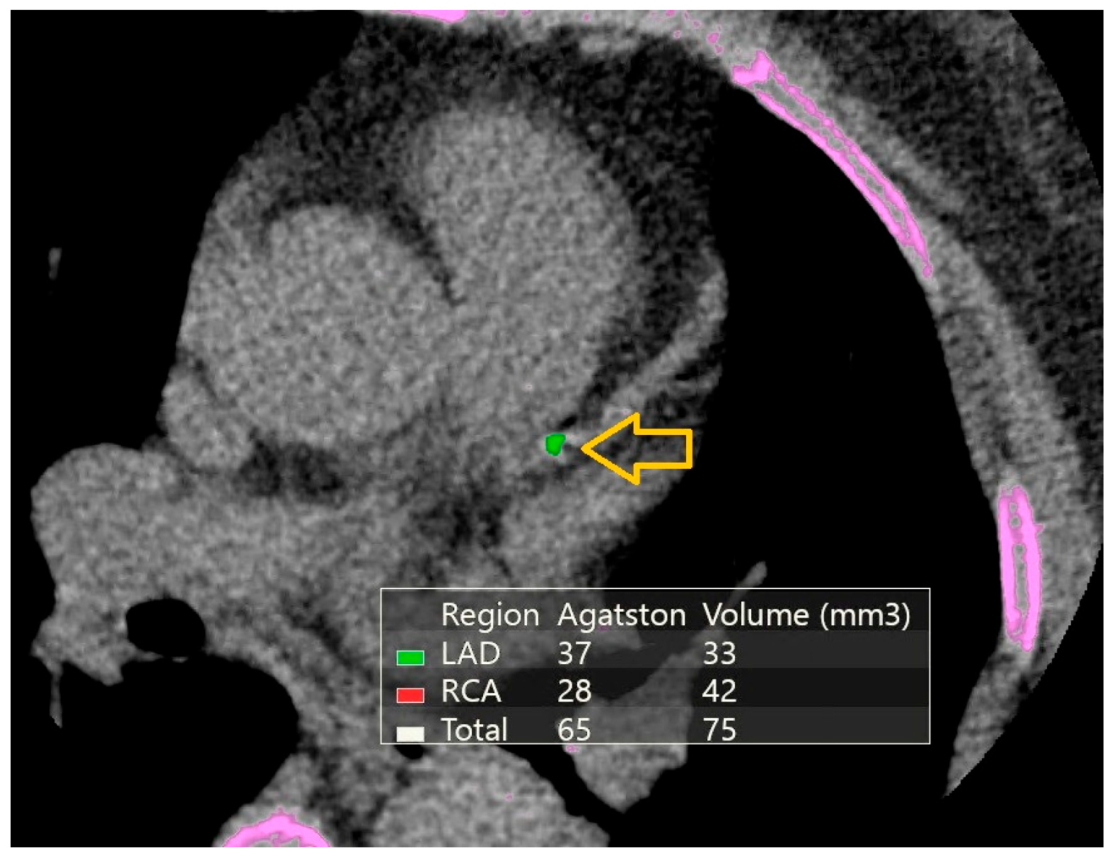 Diagnostics 16 00893 g002