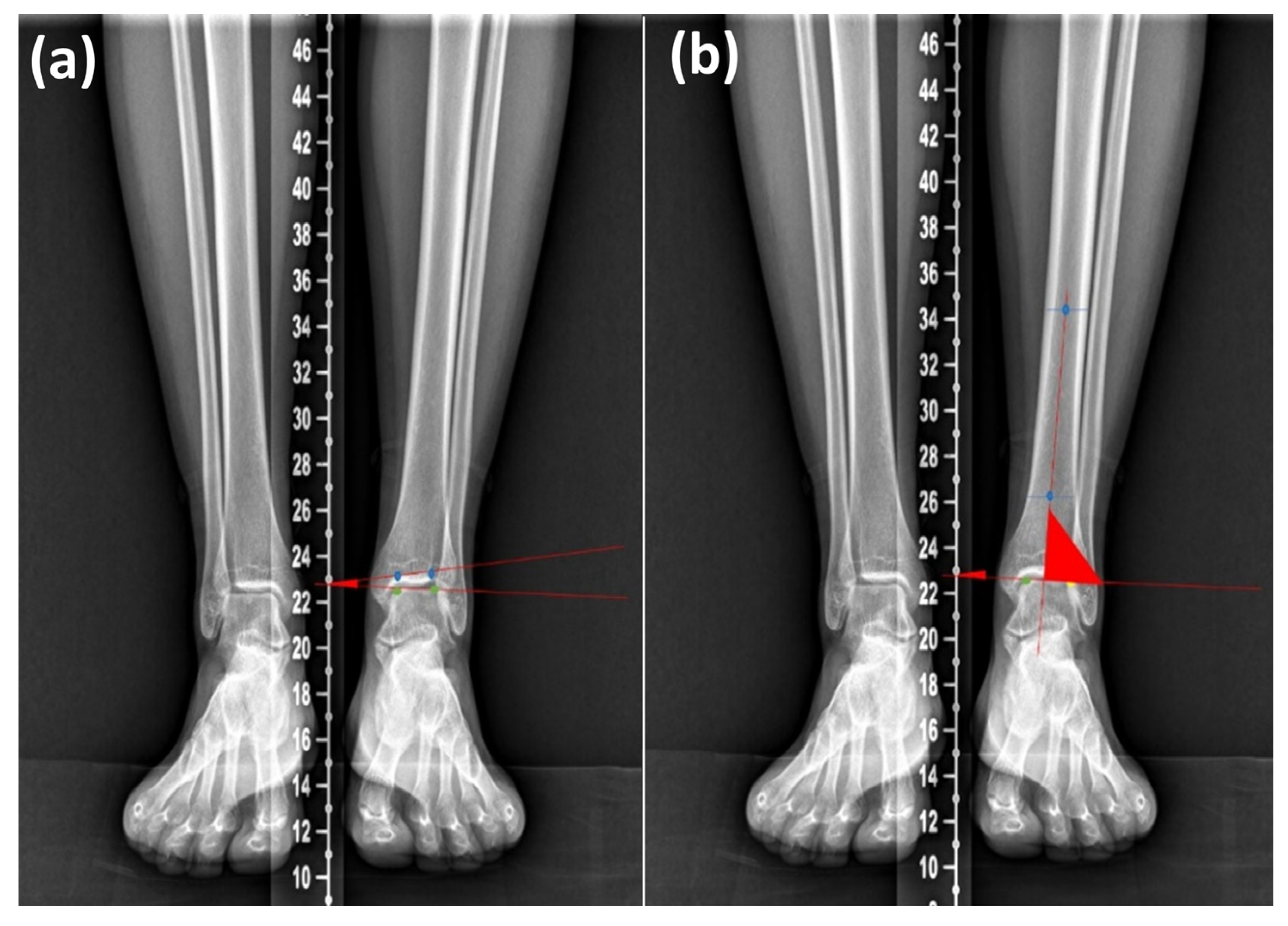Diagnostics 16 00921 g002 Diagnostics 16 00921 g002