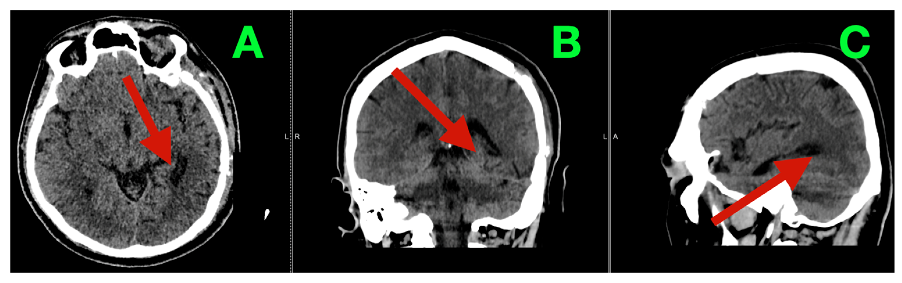 Diagnostics 16 01057 g004
