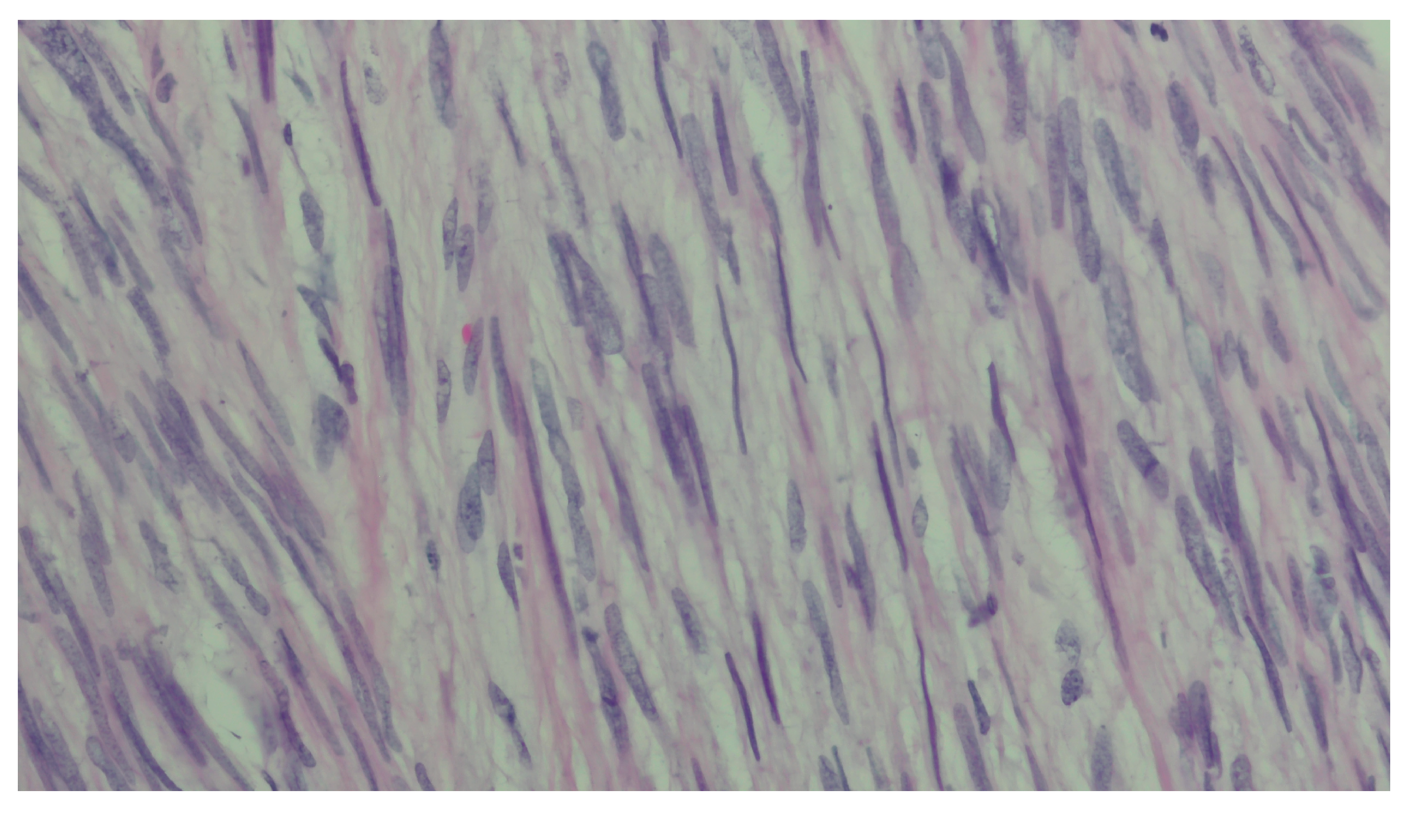Diagnostics 16 01075 g006b