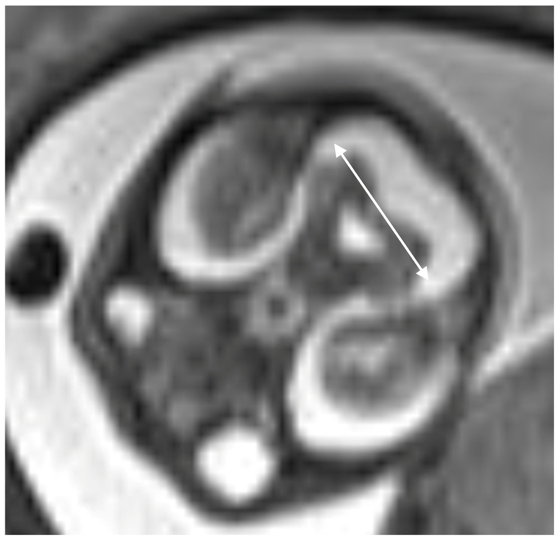 Diagnostics 16 01112 g003 Diagnostics 16 01112 g003