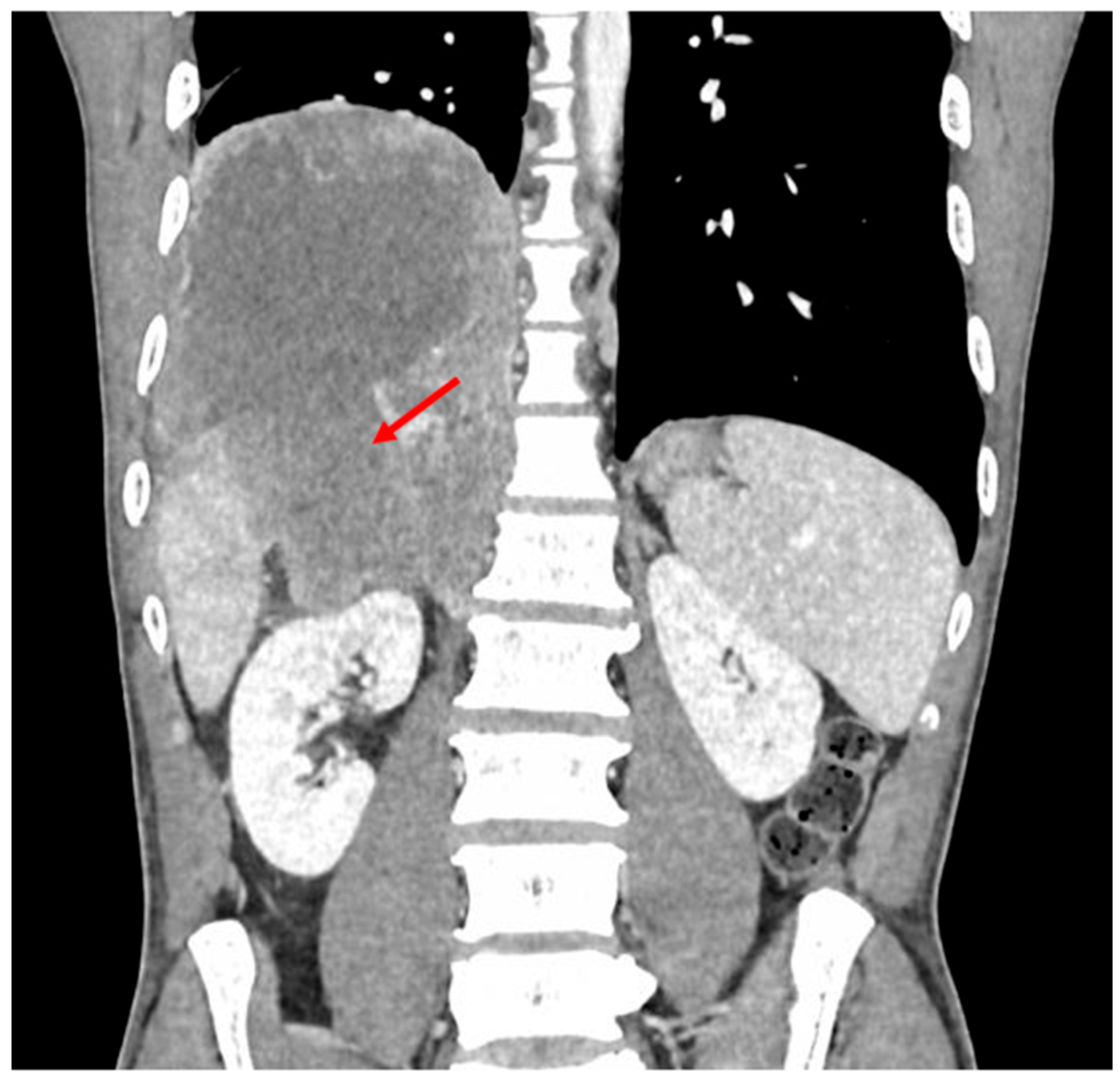 Diagnostics 16 01143 g002 Diagnostics 16 01143 g002