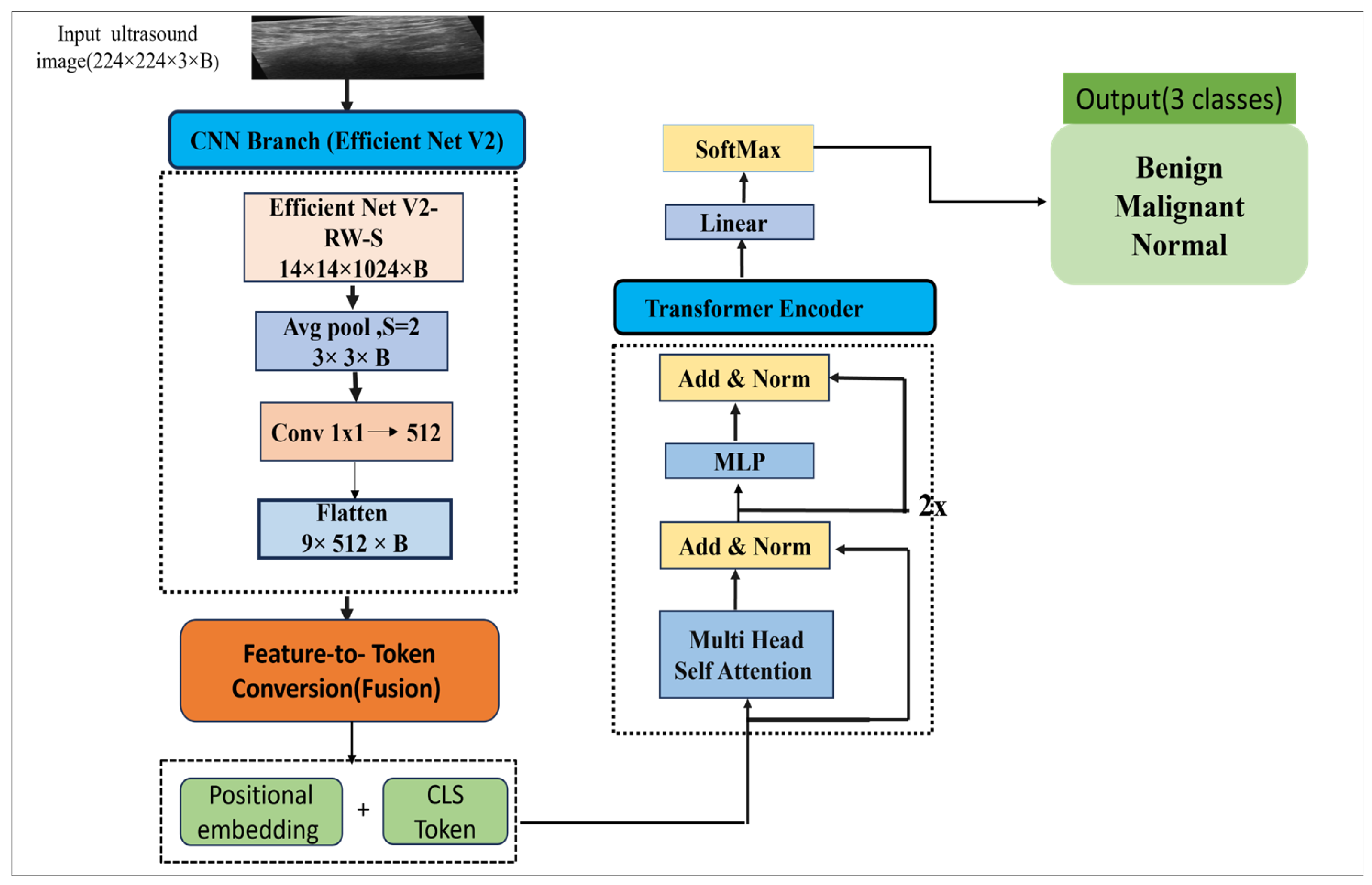 A Hybrid Model for Ultrasound Image-Based Breast Cancer Diagnosis Using ...