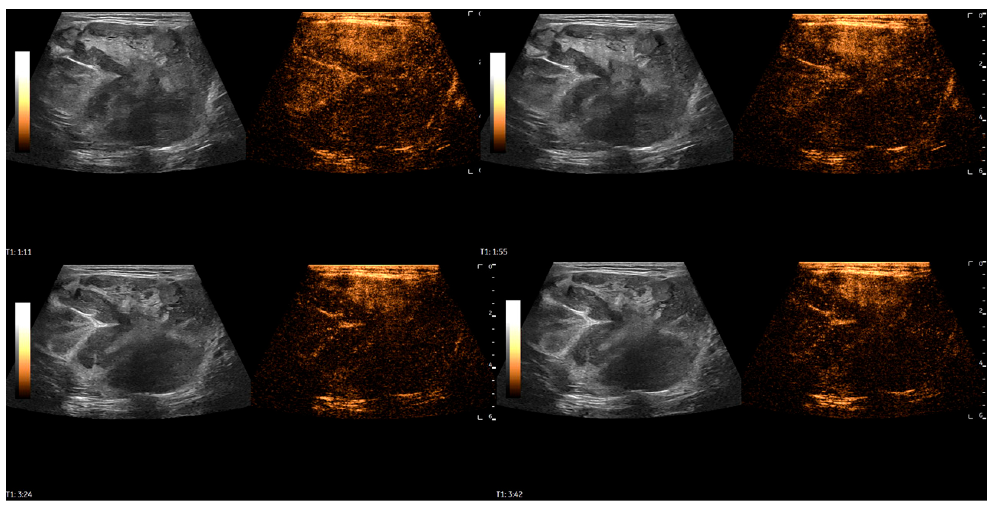 Diagnostics 16 01286 g004