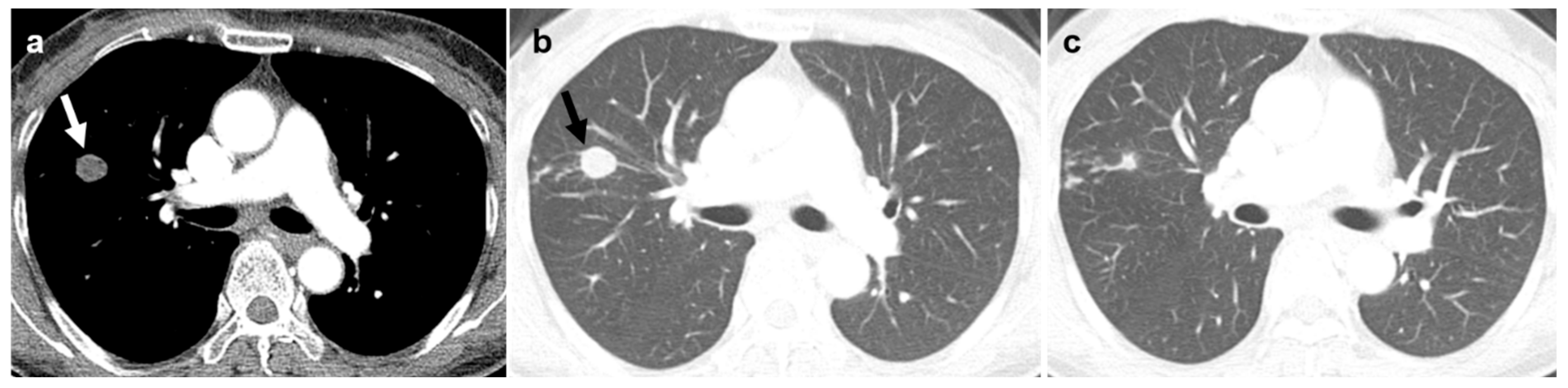 Diagnostics 16 01321 g004 Diagnostics 16 01321 g004