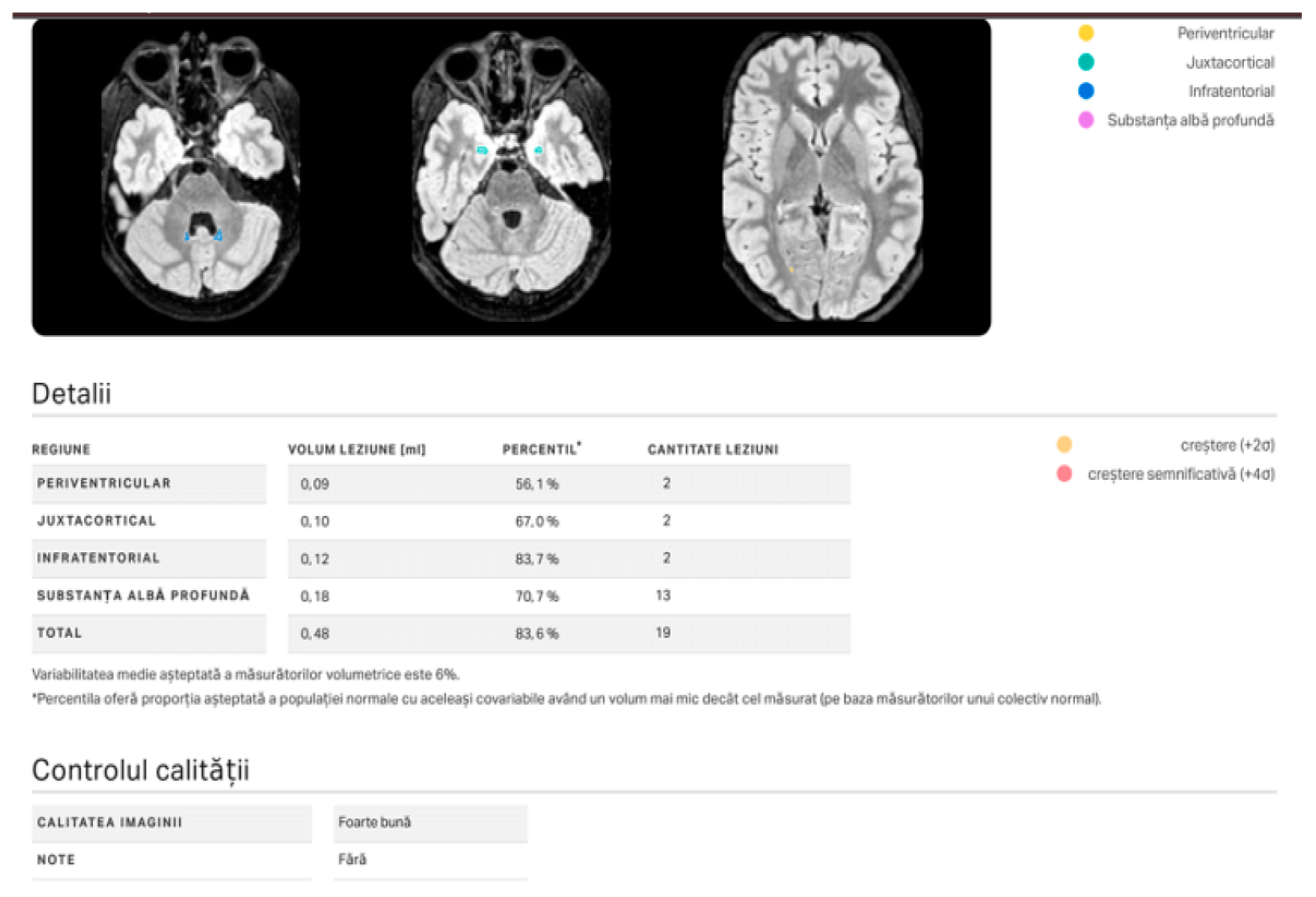Bridging Brain Science and Technology: How AI Is Shaping the