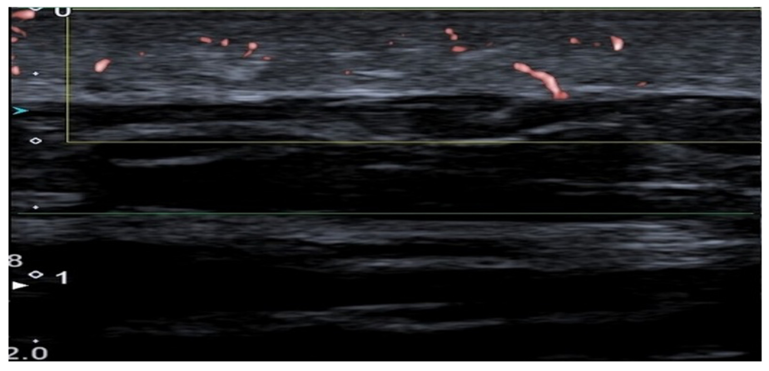 Diagnostics 16 01435 g004
