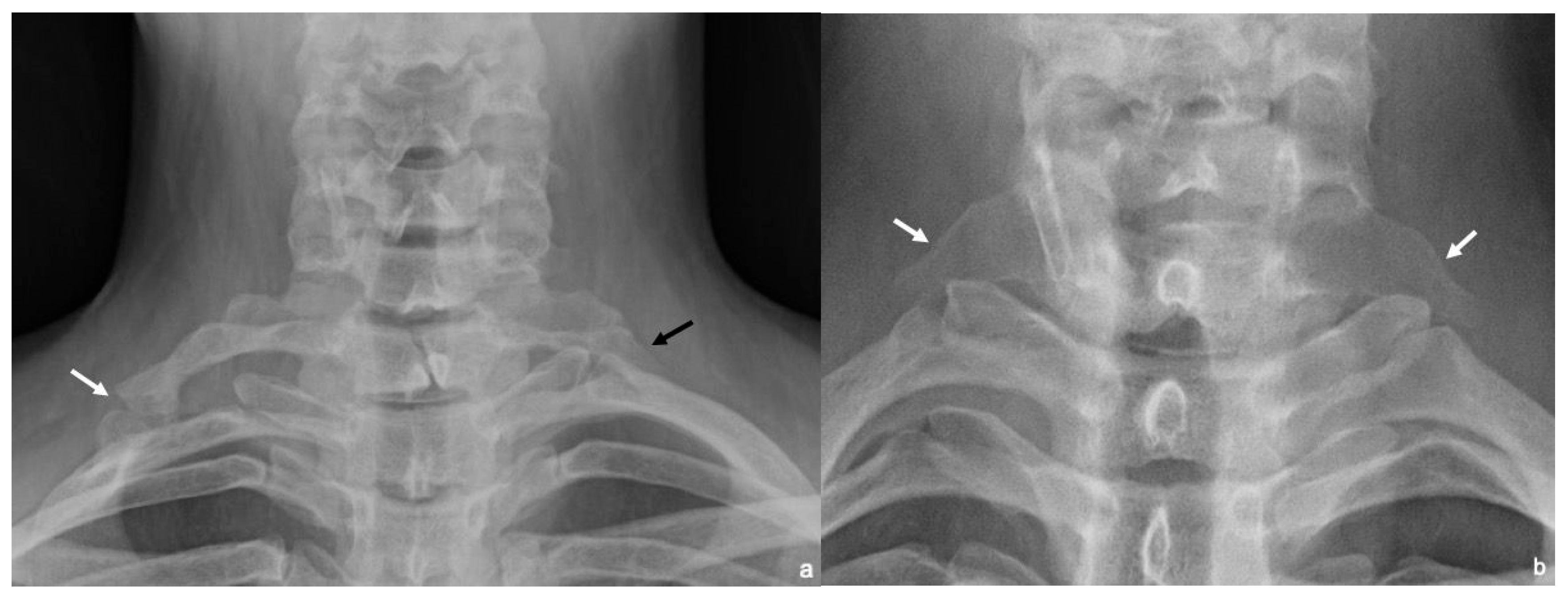 Diagnostics 16 01437 g002 Diagnostics 16 01437 g002