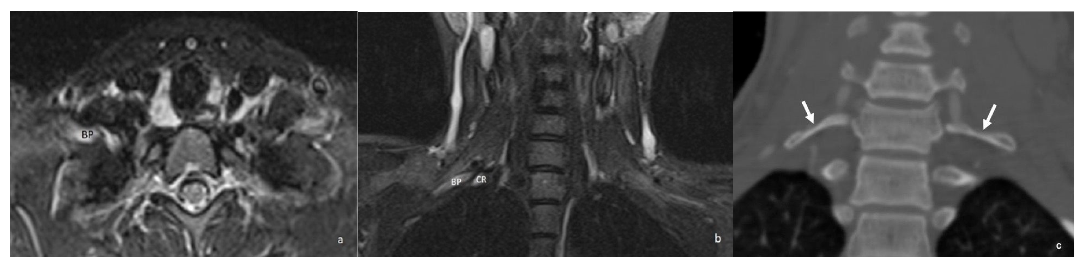 Diagnostics 16 01437 g012 Diagnostics 16 01437 g012