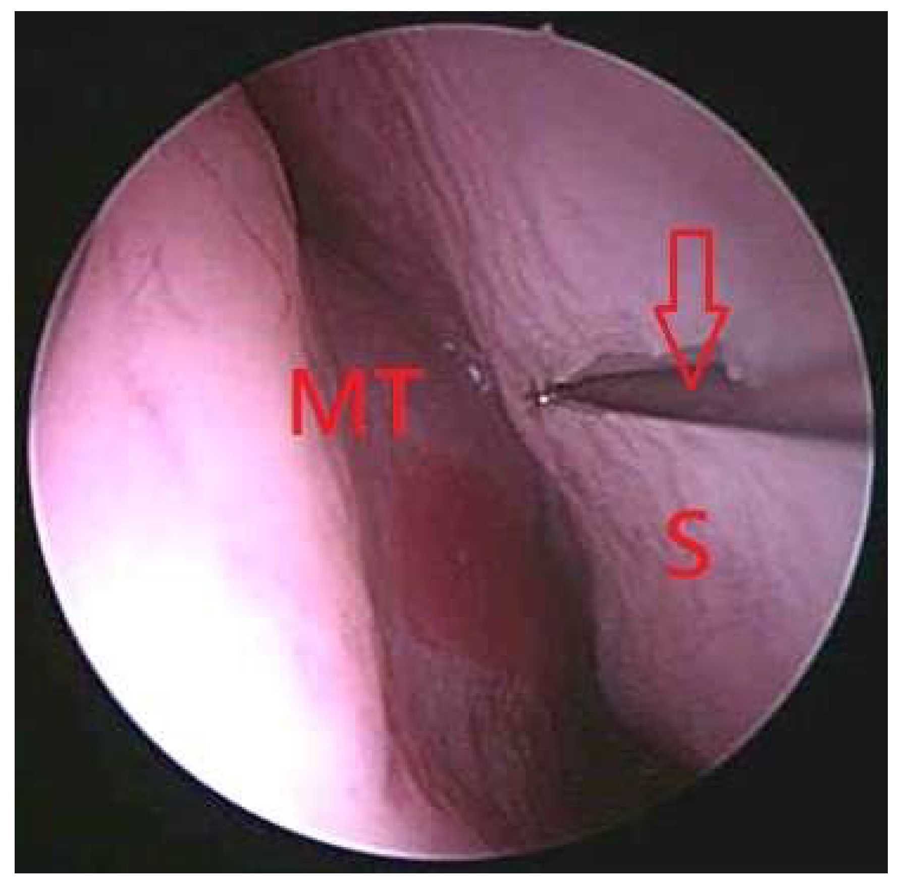 Diagnostics 16 01547 g005 Diagnostics 16 01547 g005