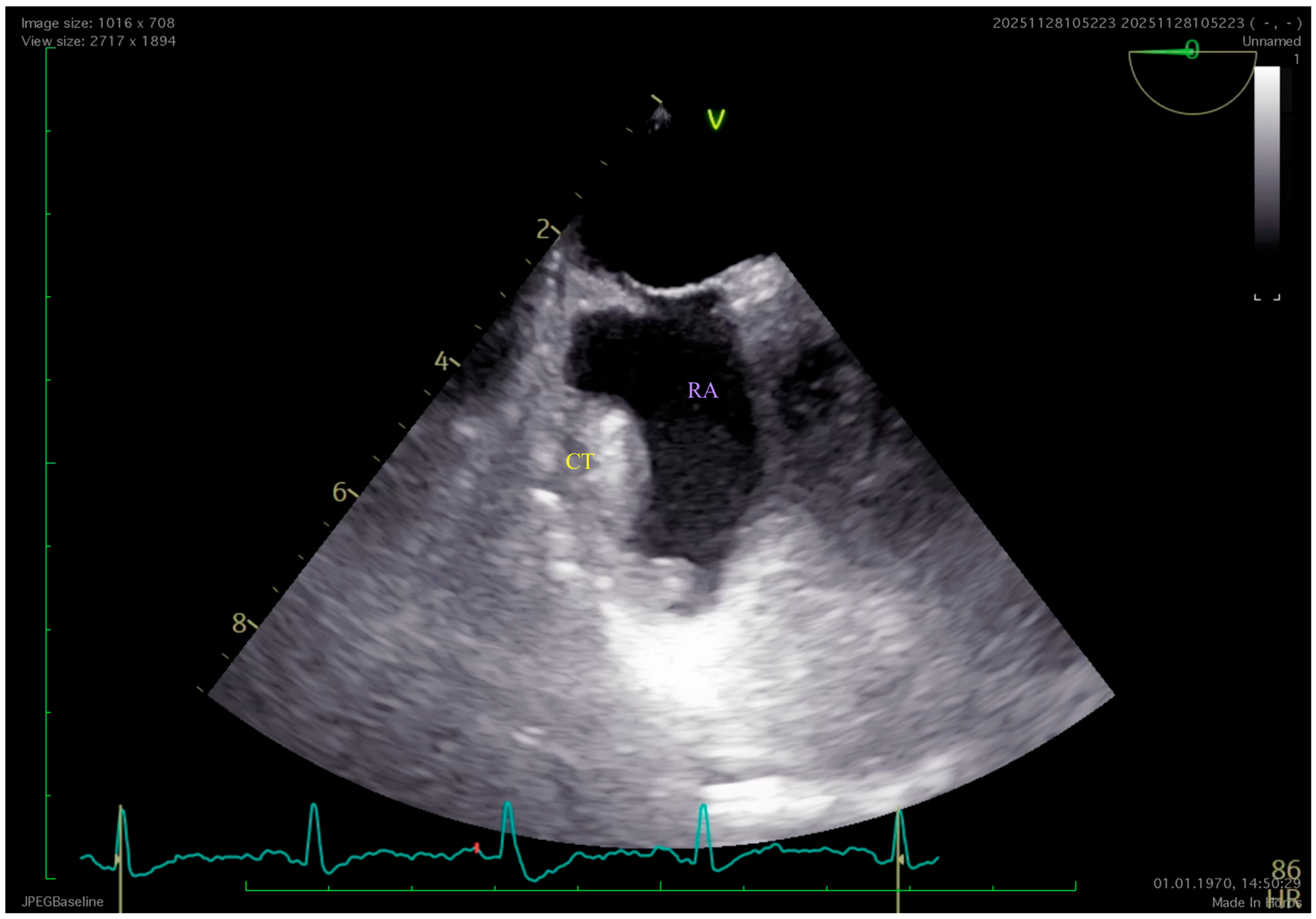 Diagnostics 16 01615 g003 Diagnostics 16 01615 g003