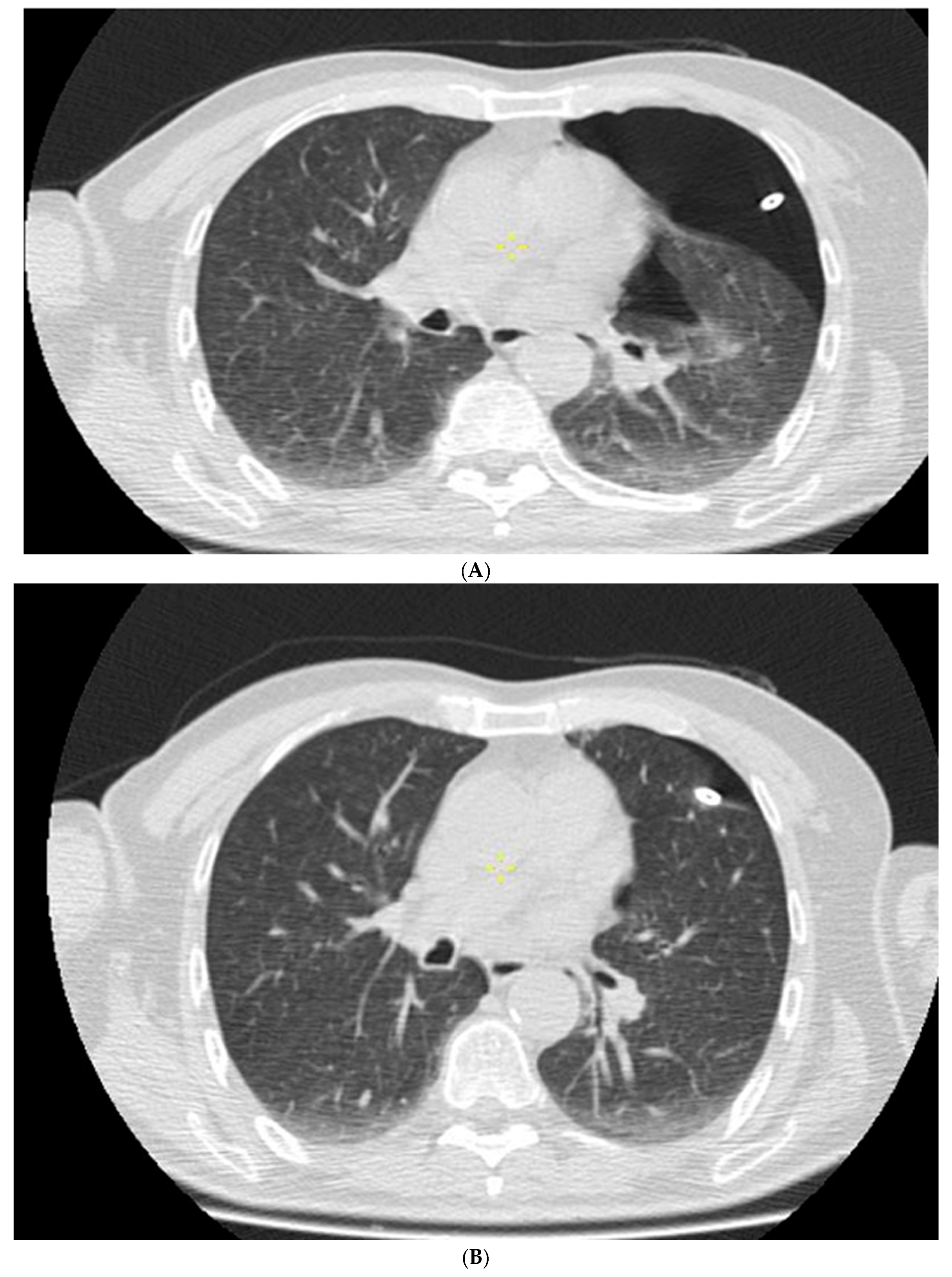 Diagnostics 16 01792 g002 Diagnostics 16 01792 g002