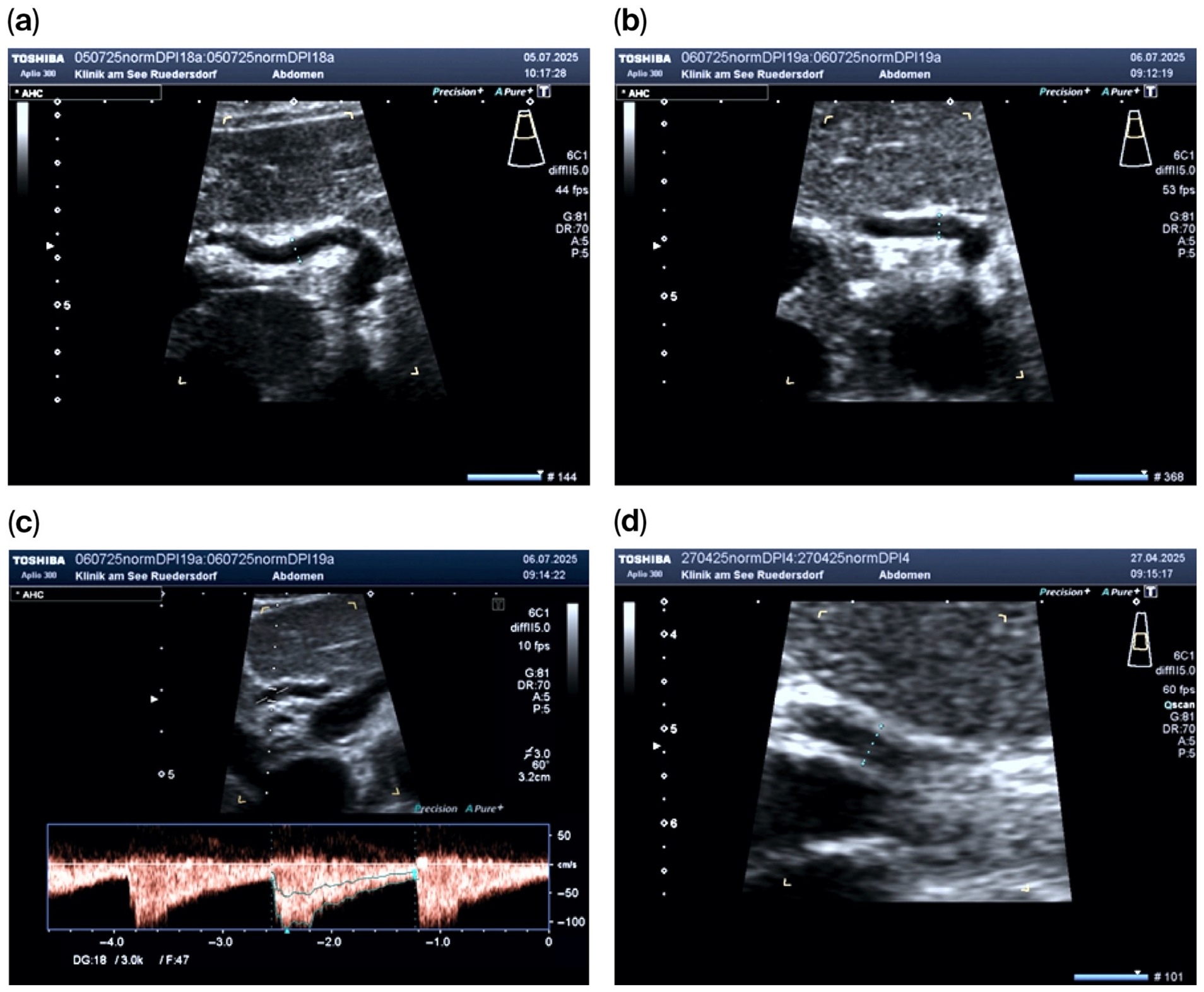 Diagnostics 16 01840 g002