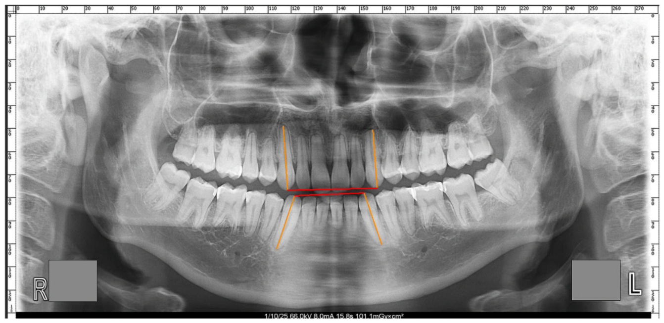Diagnostics 16 01892 g003