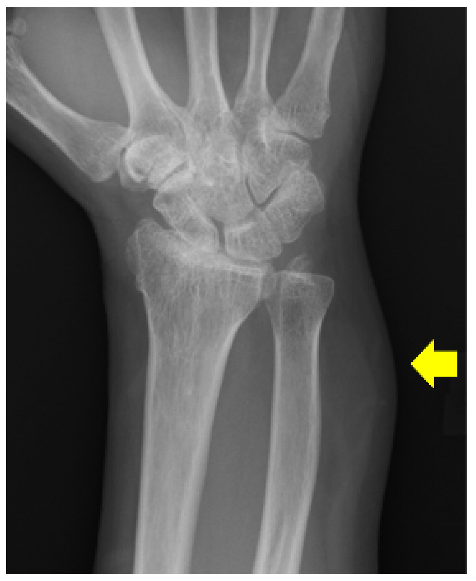 Diagnostics 16 02028 g001 Diagnostics 16 02028 g001