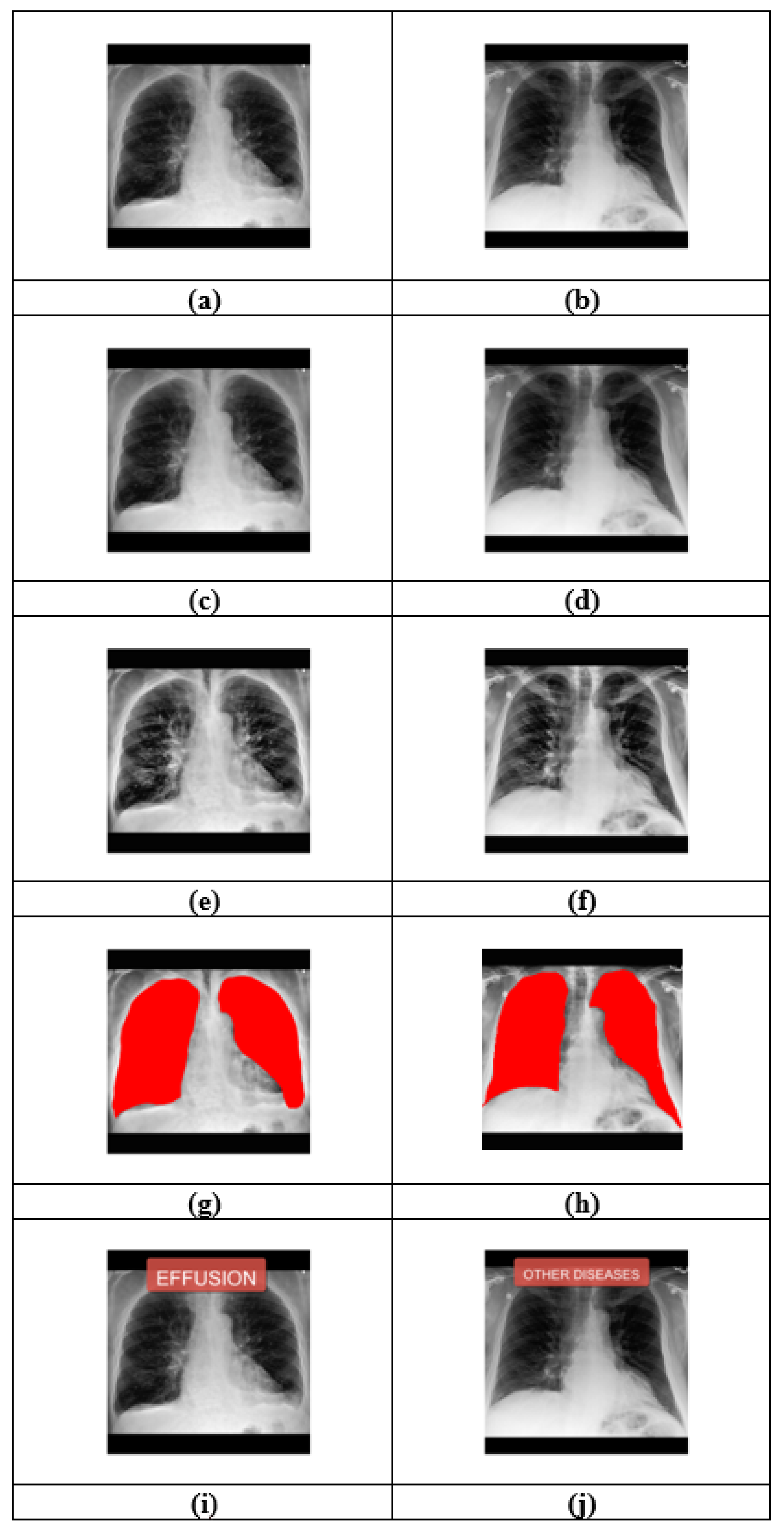 Diagnostics 16 02096 g007 Diagnostics 16 02096 g007