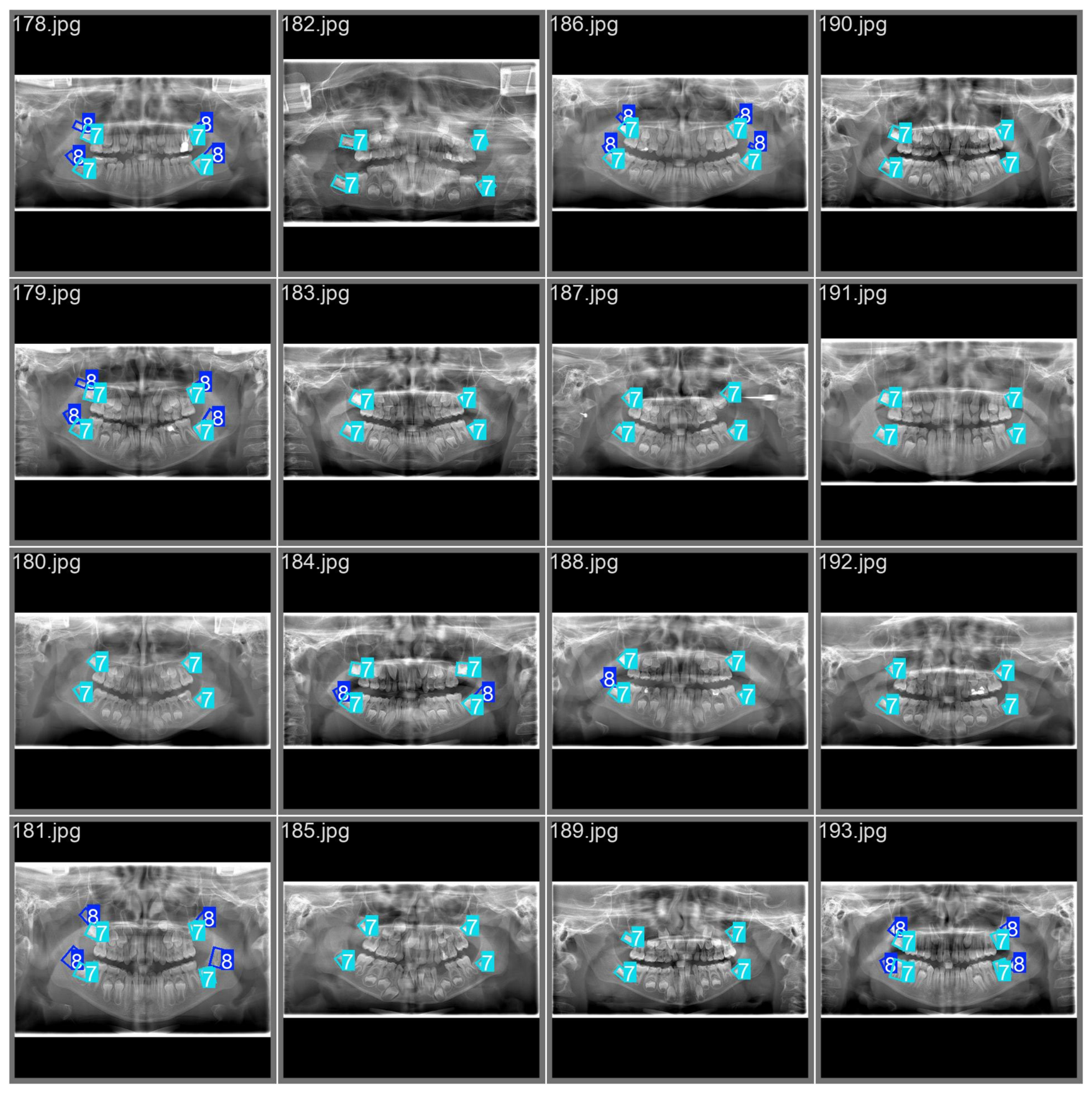Diagnostics 16 02141 g007