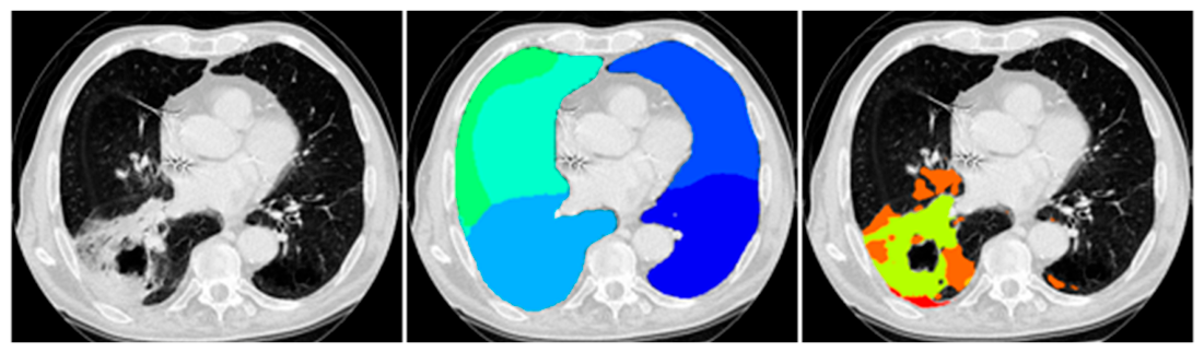 Diagnostics 16 03008 g001