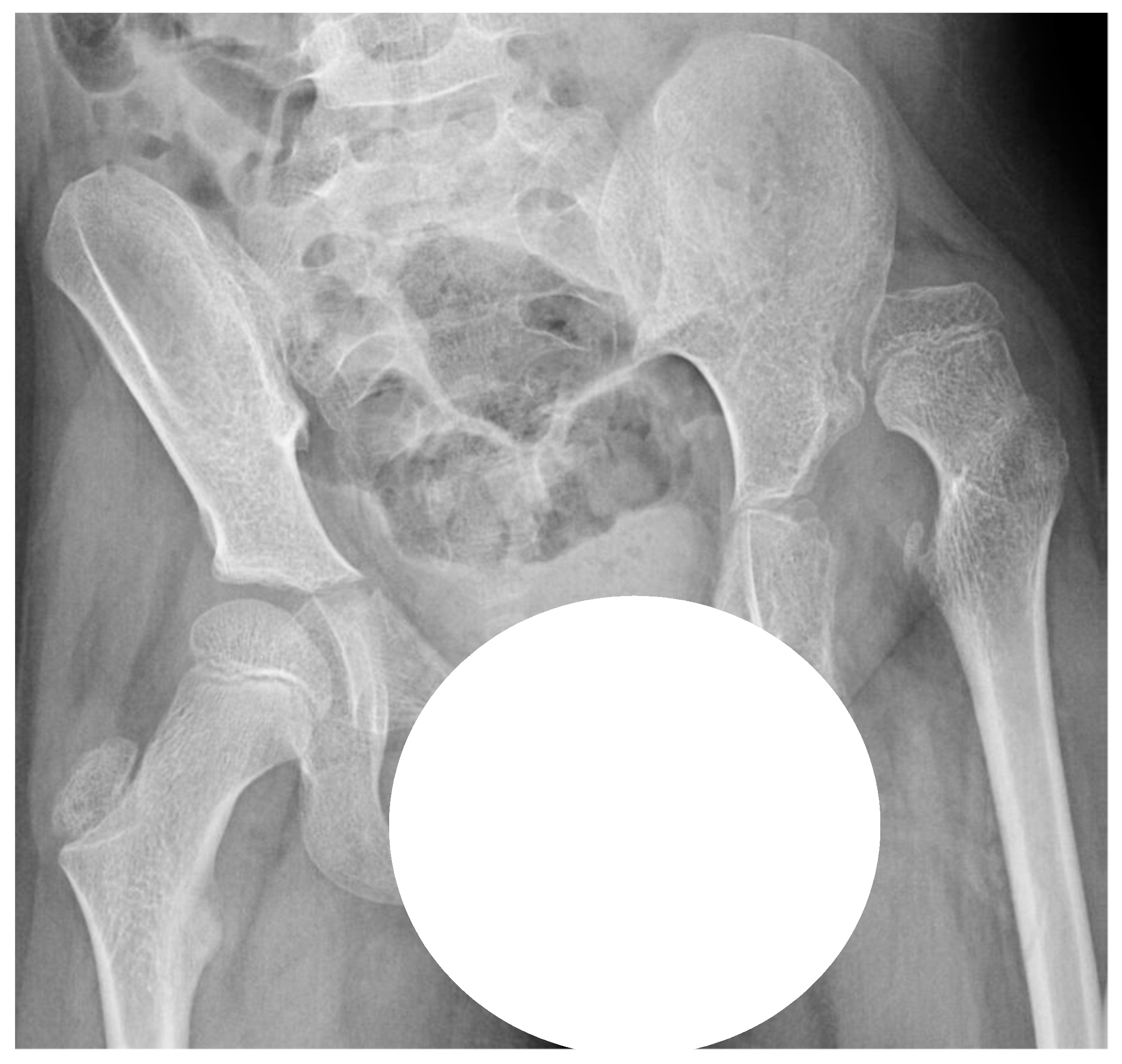 Disabilities 01 00012 g001 550