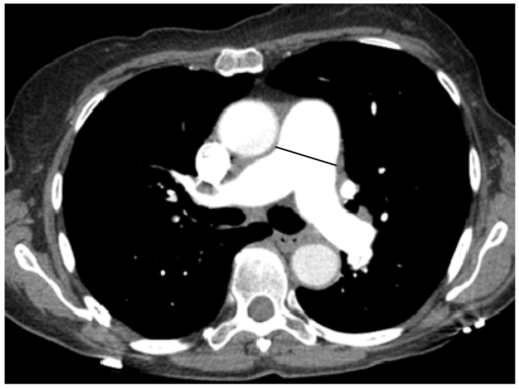 Diseases Free Full-Text The Significance of Pulmonary Diseases Free Full-Text The Significance of Pulmonary