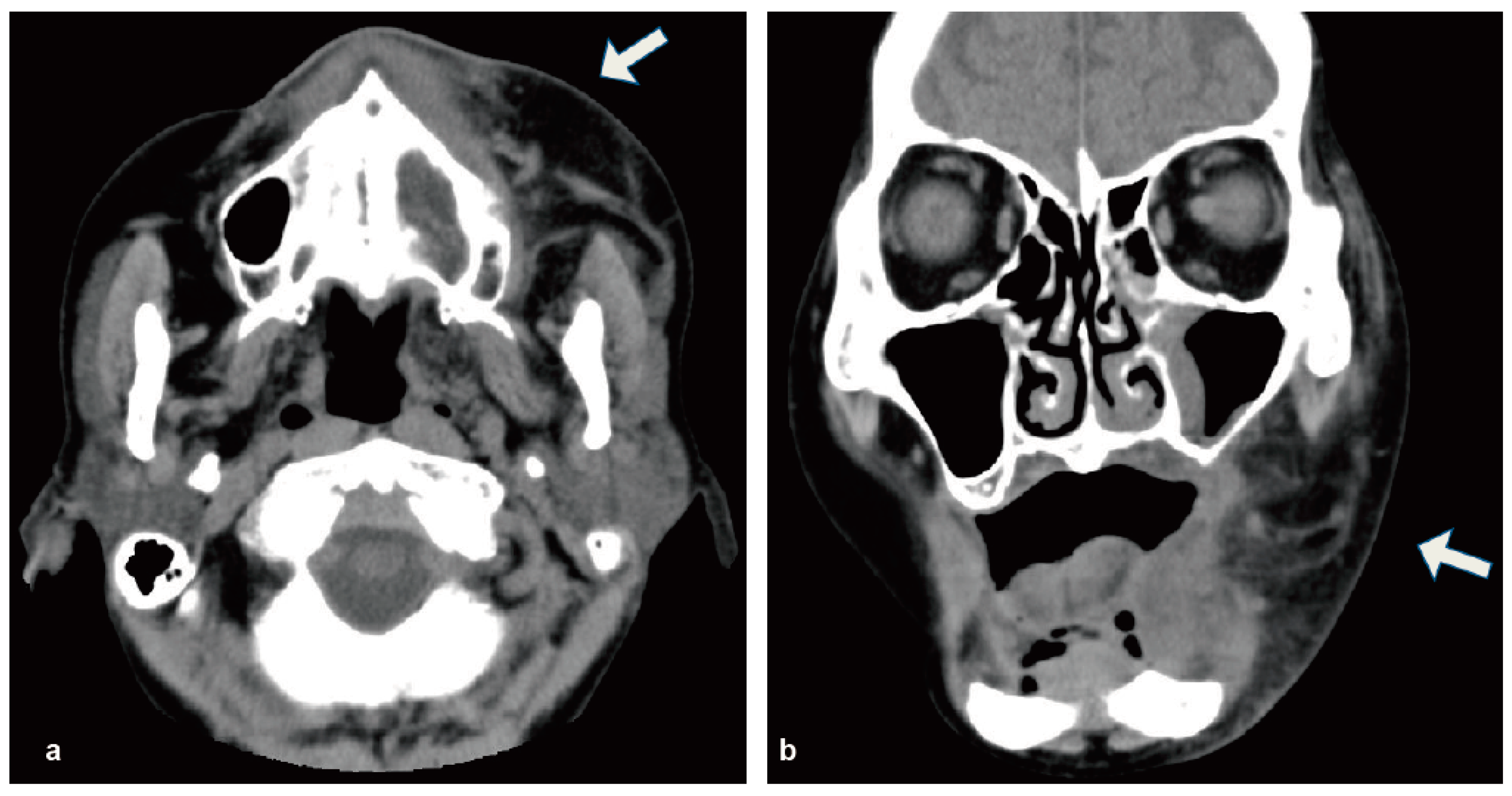 Diseases 05 00017 g001