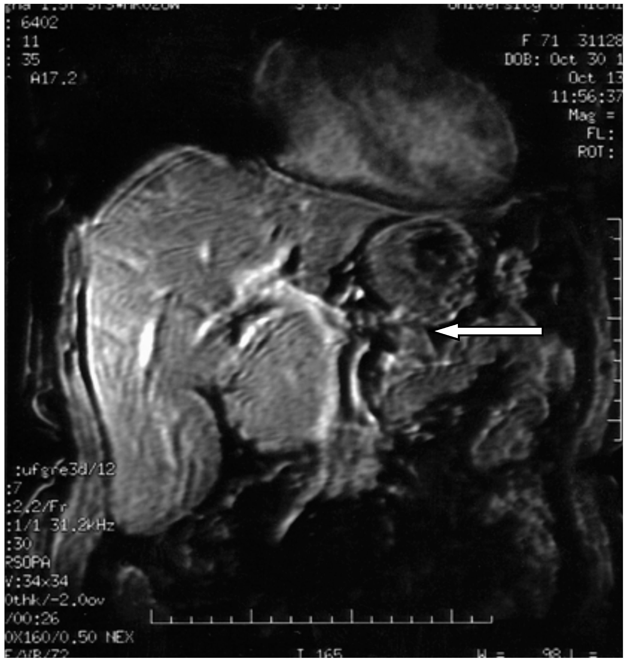 Diseases 06 00008 g007 550