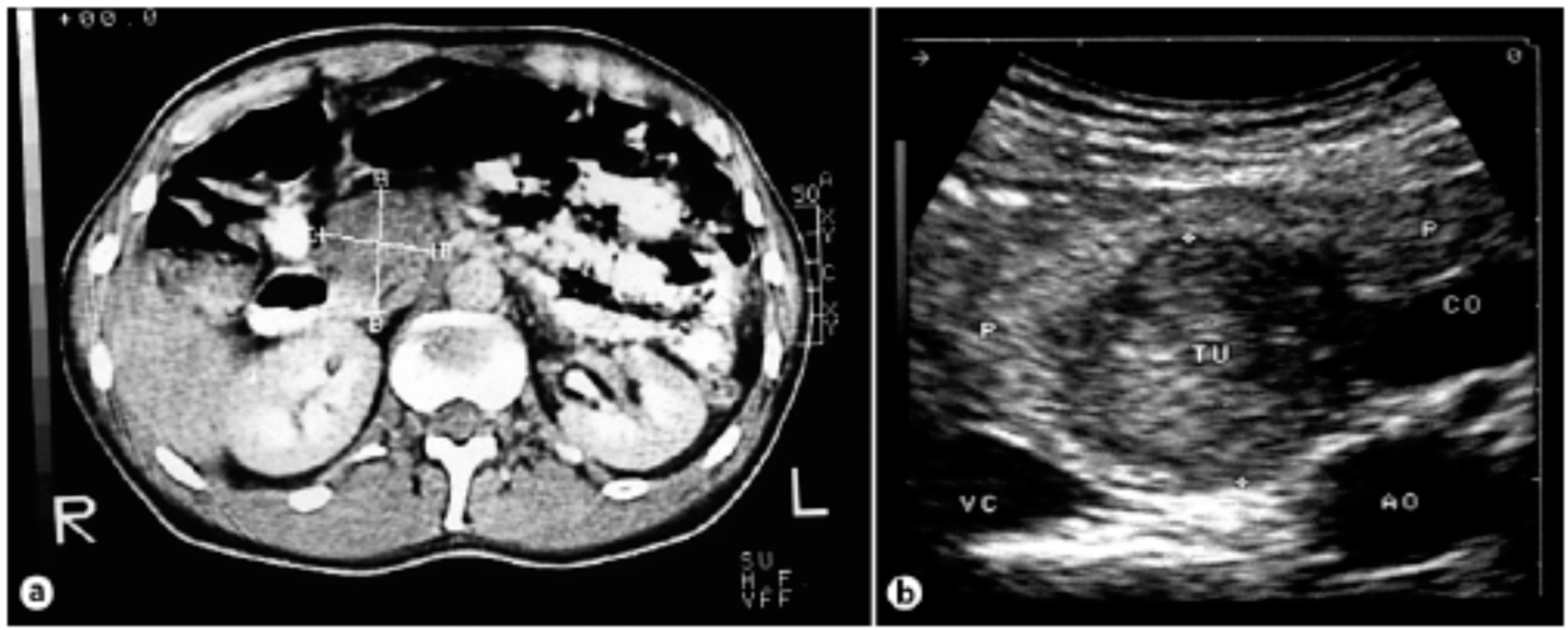Diseases 06 00008 g008 550