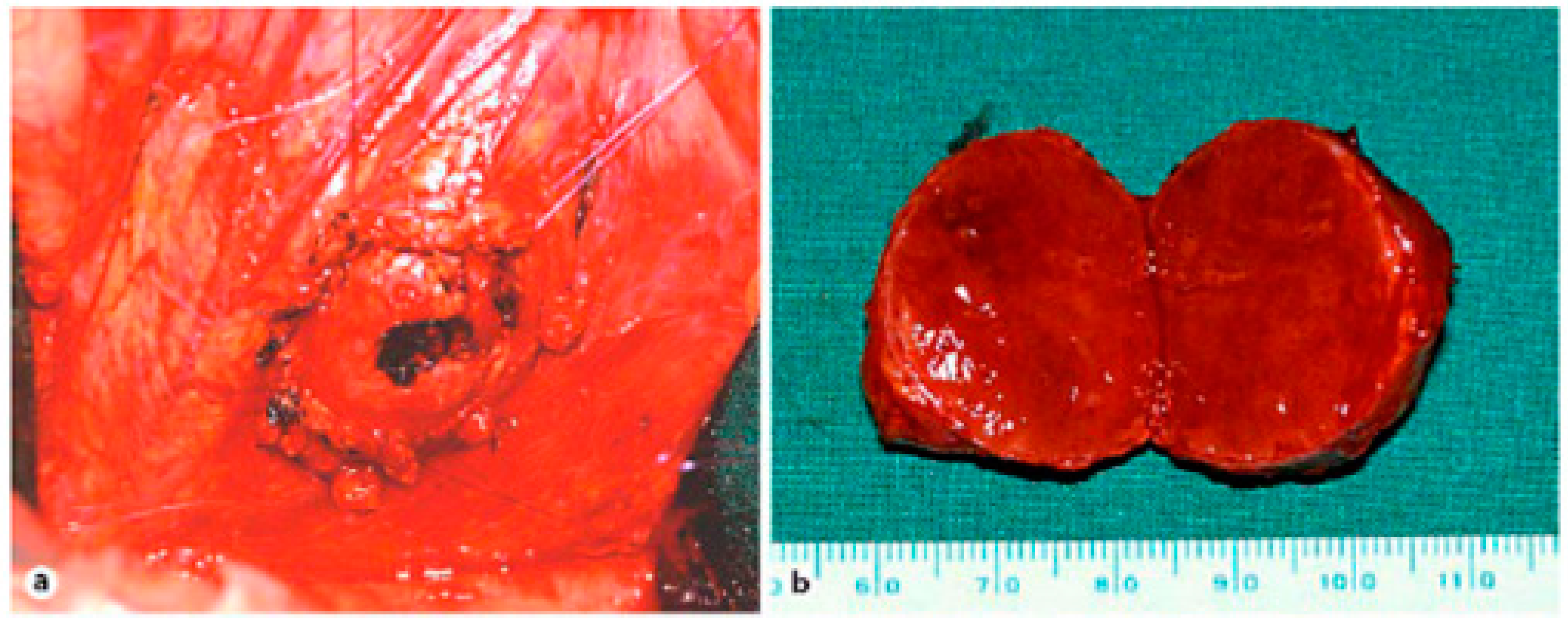 Diseases 06 00008 g009 550