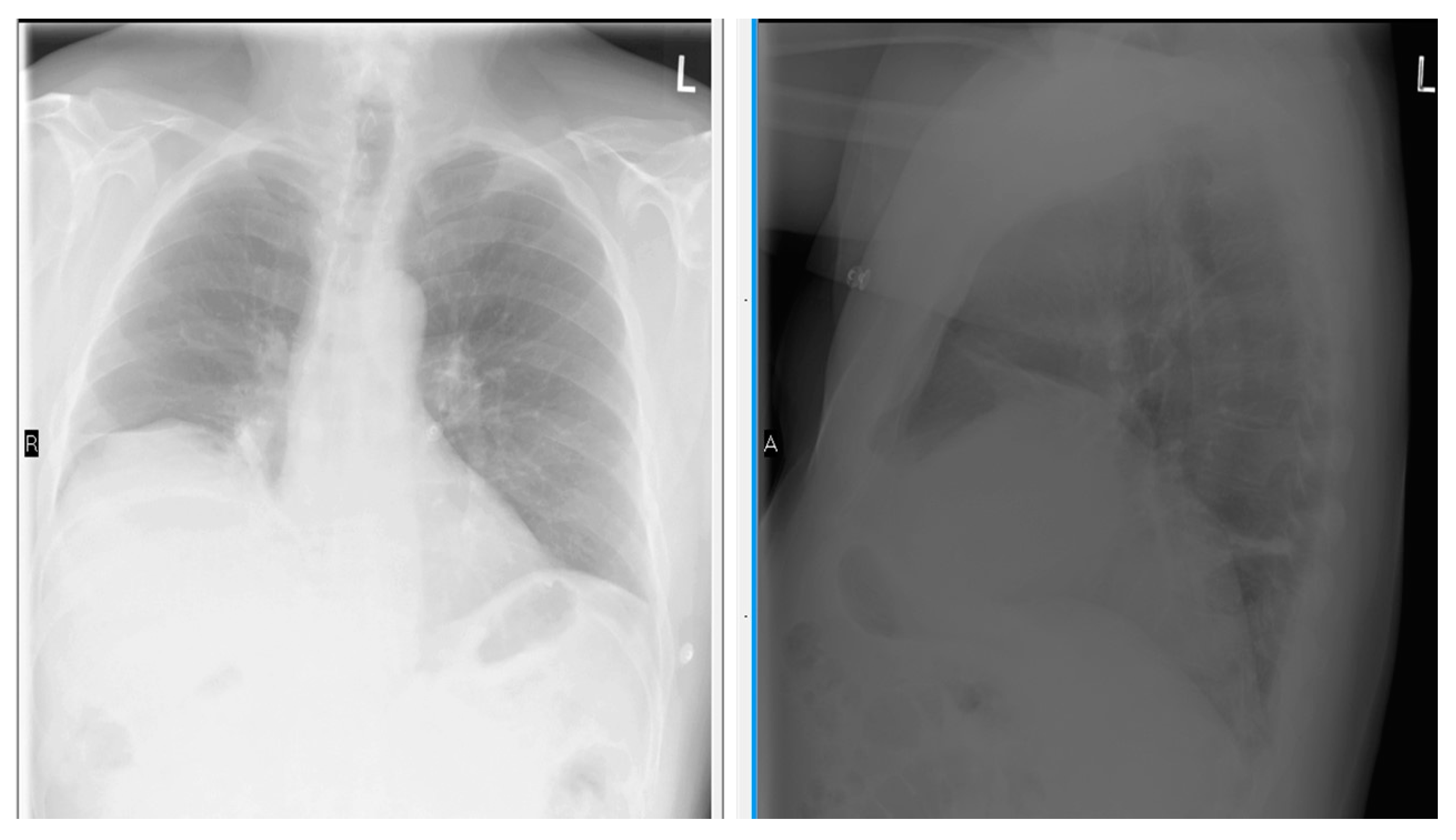 Diseases 06 00016 g003 Diseases 06 00016 g003