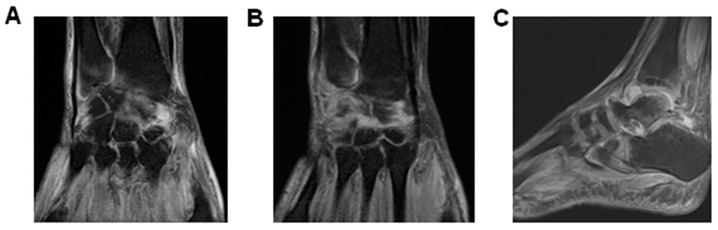 Diseases 06 00053 g002