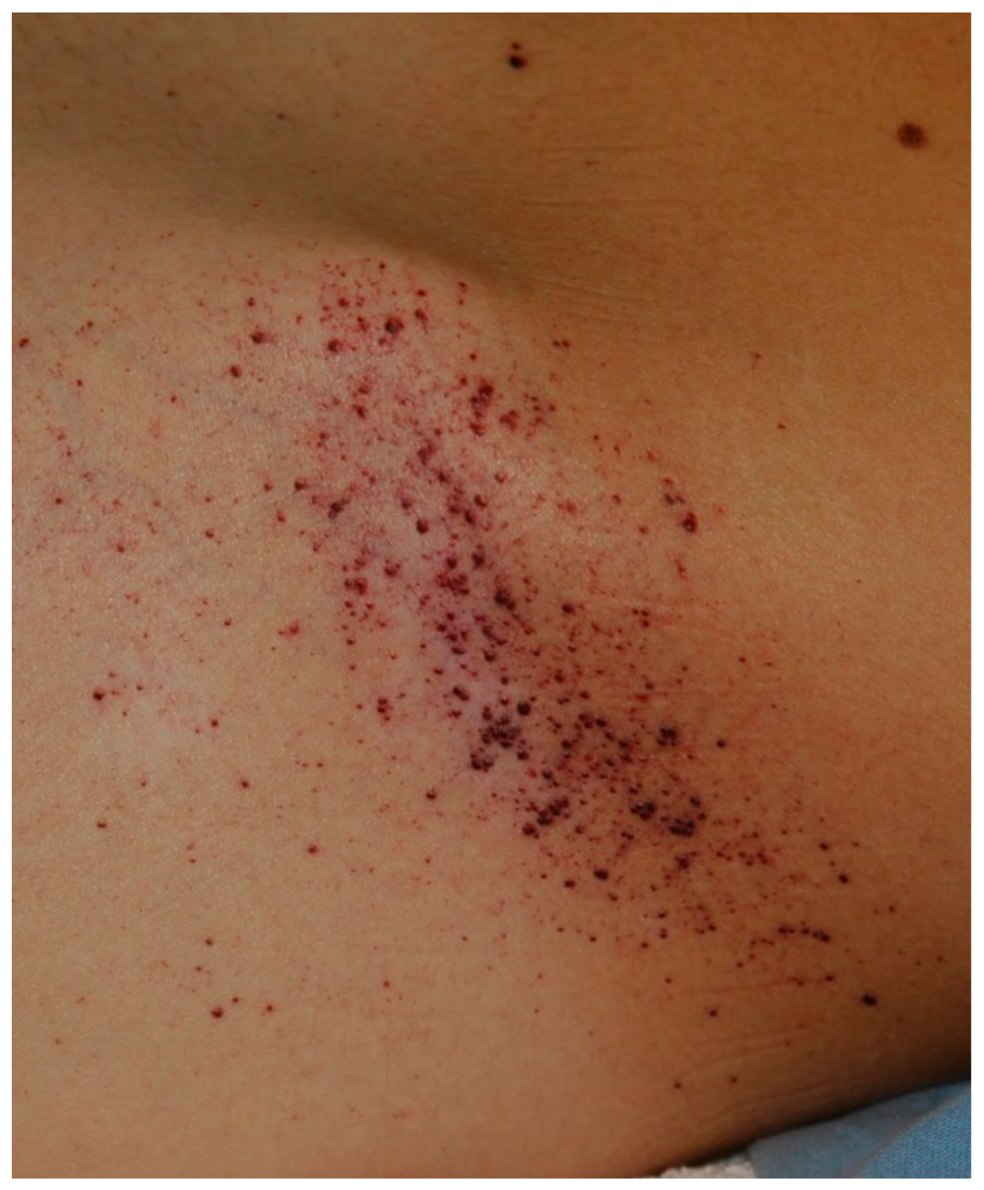 Diseases 06 00055 g001