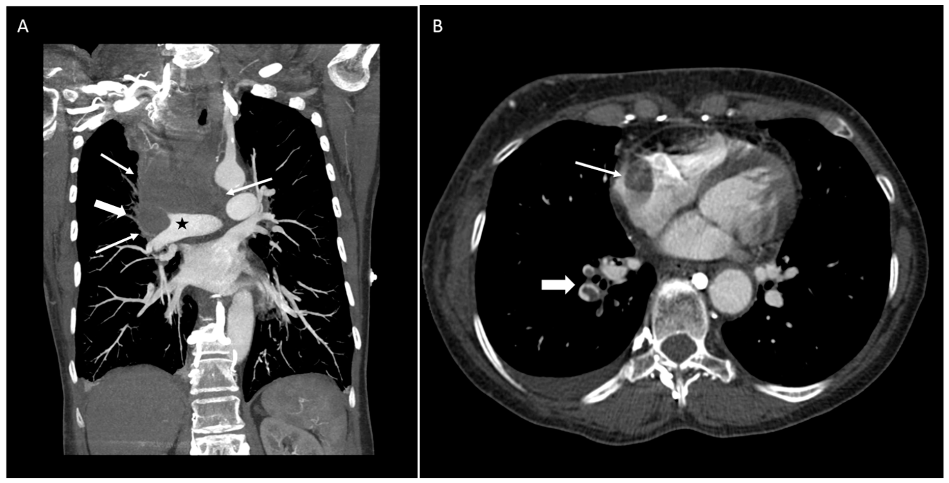 Diseases 06 00108 g001 550
