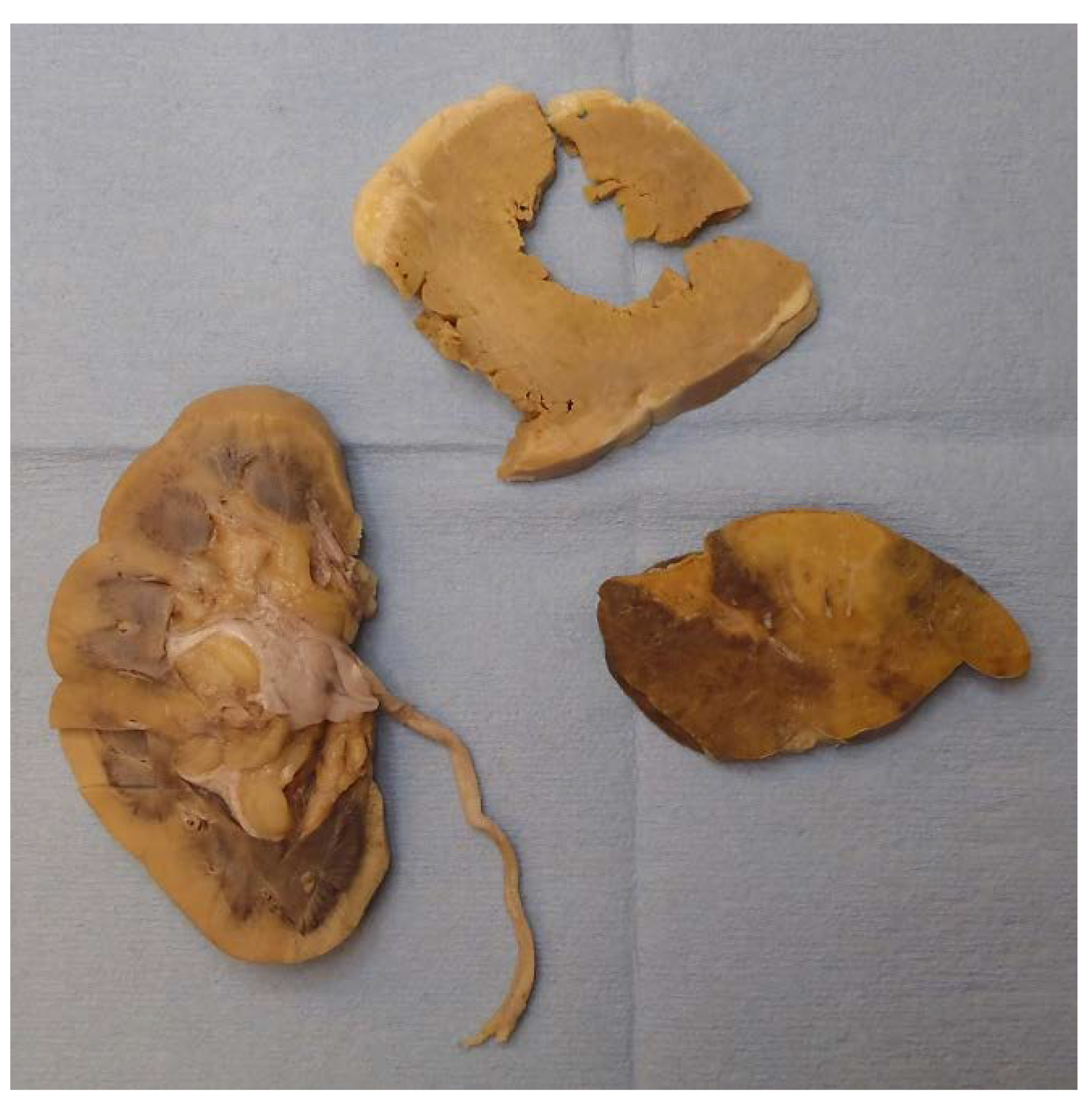 Diseases 09 00040 g002