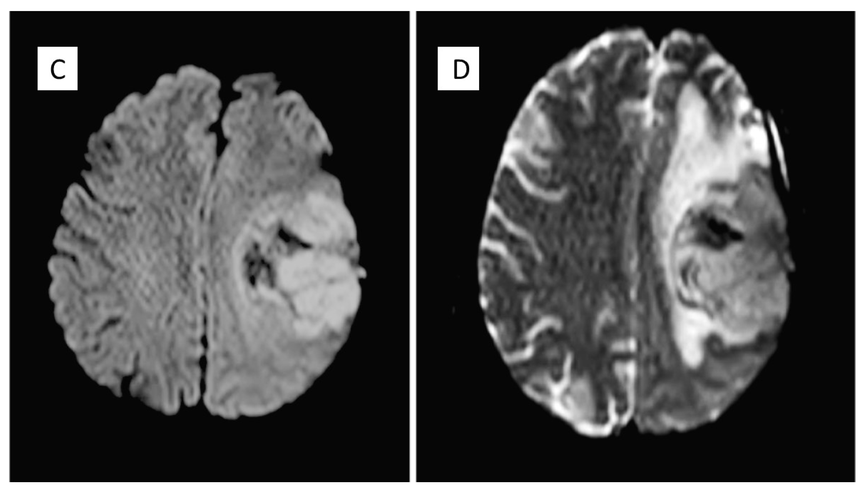Diseases 09 00063 g001b