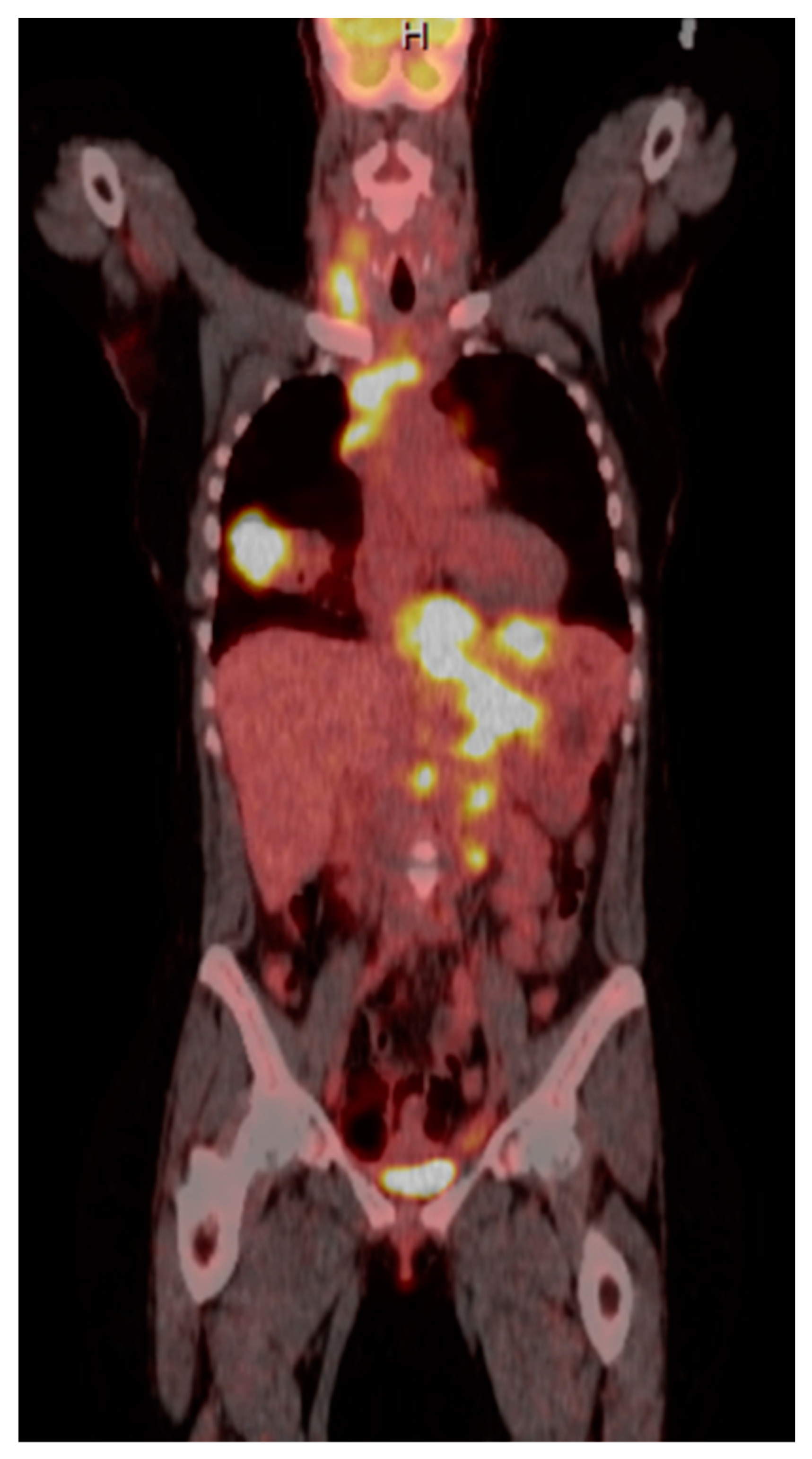 Diseases 10 00061 g001