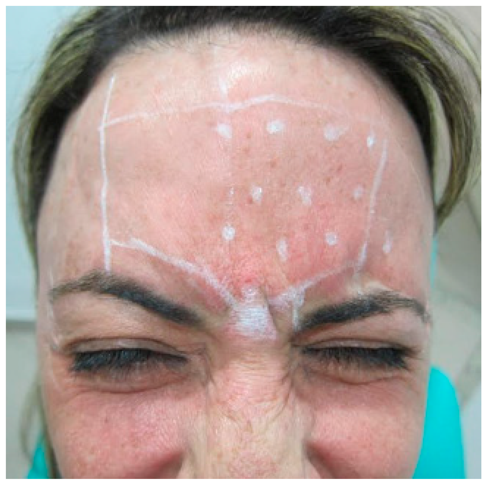 Diseases 10 00067 g004